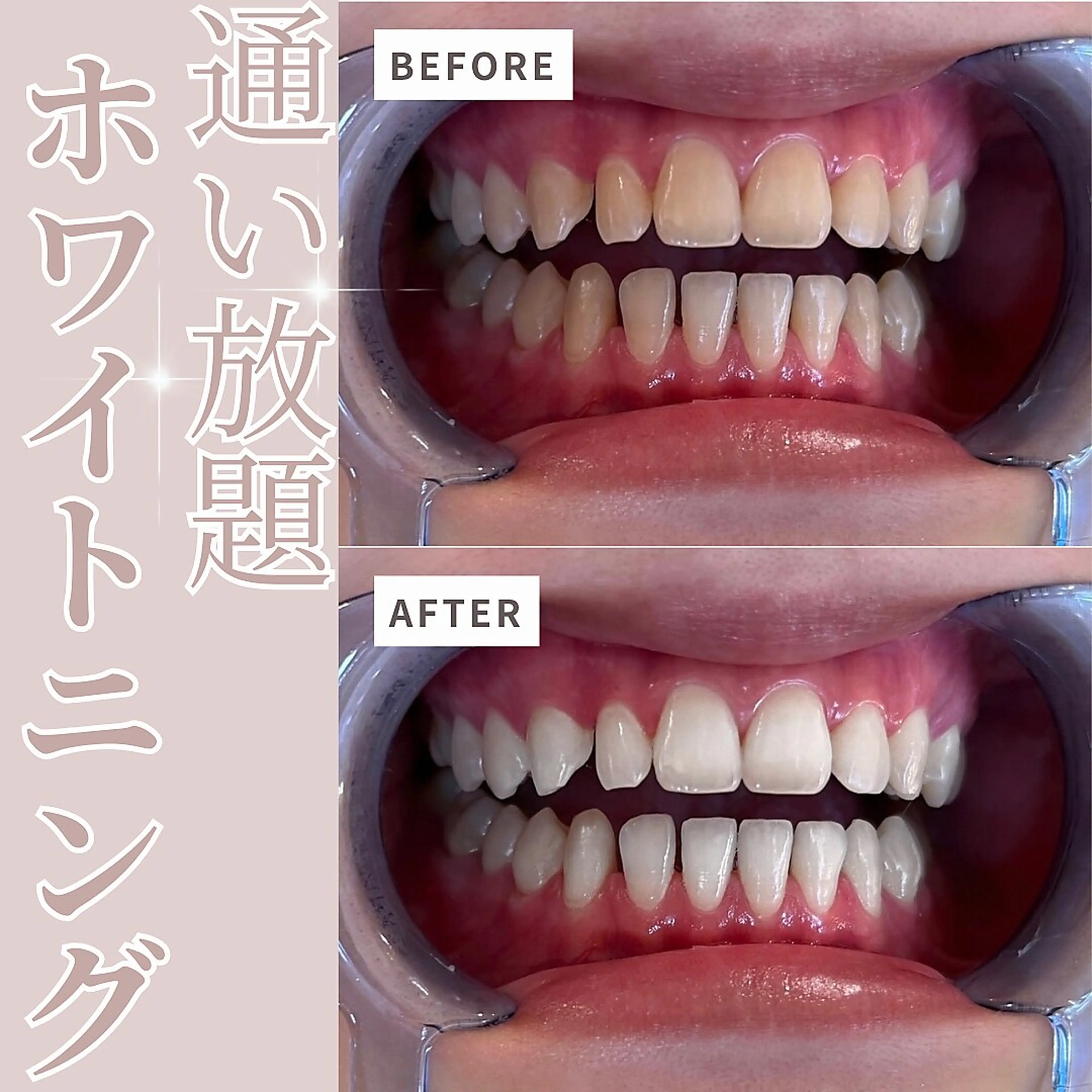 セルフホワイトニング エクシア　岡山駅前店の内観・外観3