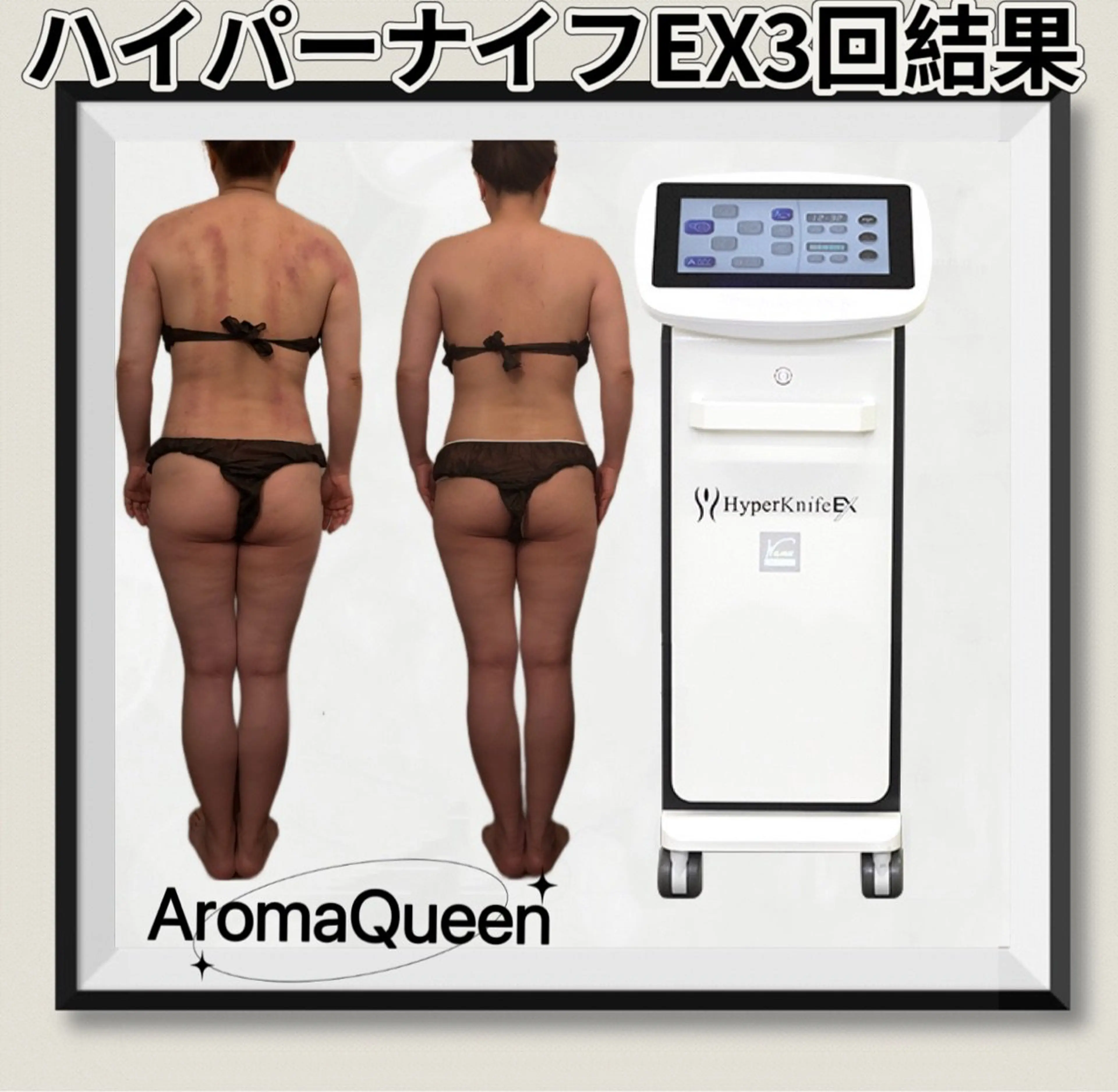 AromaQueen痩身癒し小顔矯正コルギの内観・外観2