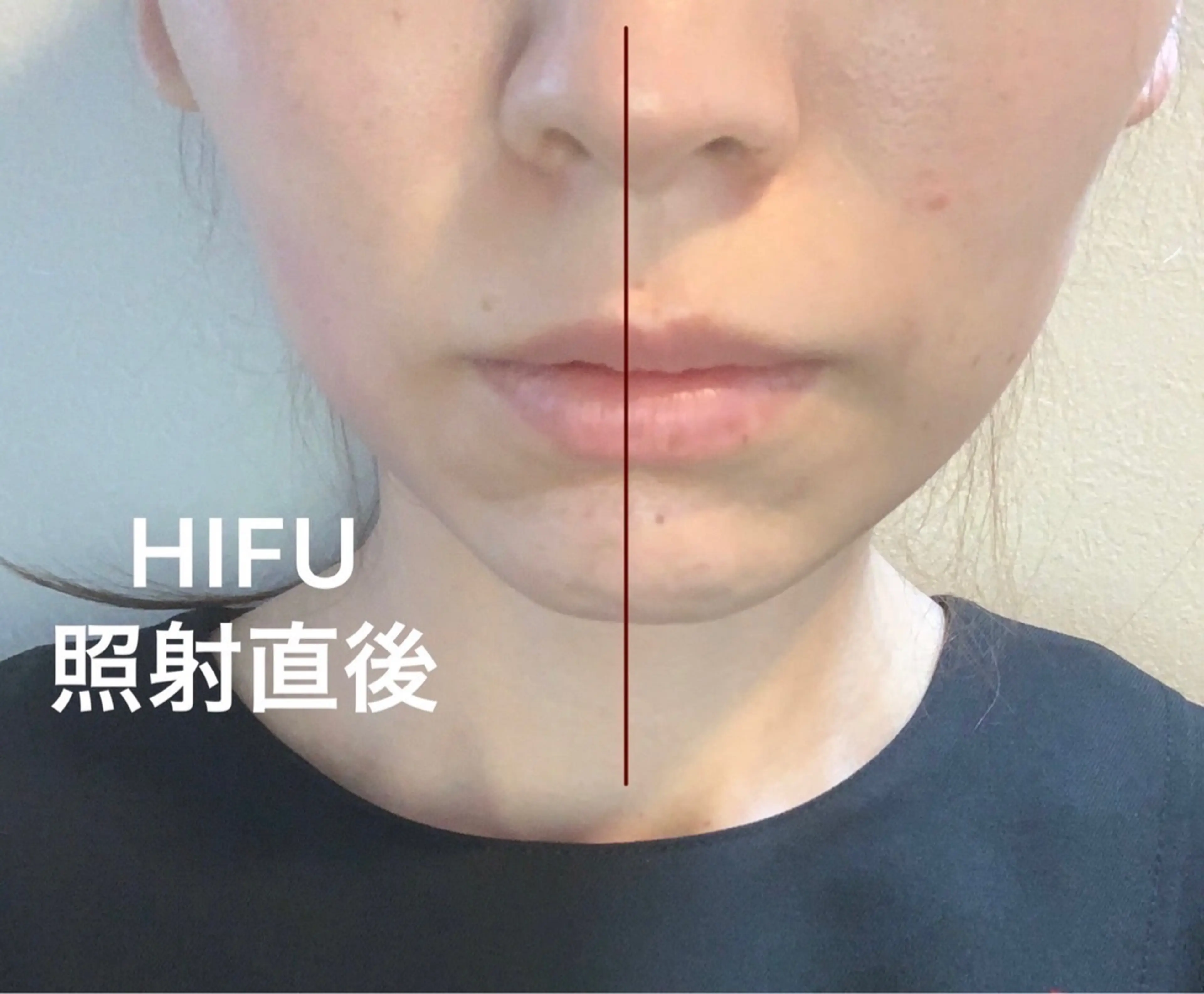 ハーブ/ニードルピーリング正規導入店 Oasis相模大野の内観・外観3