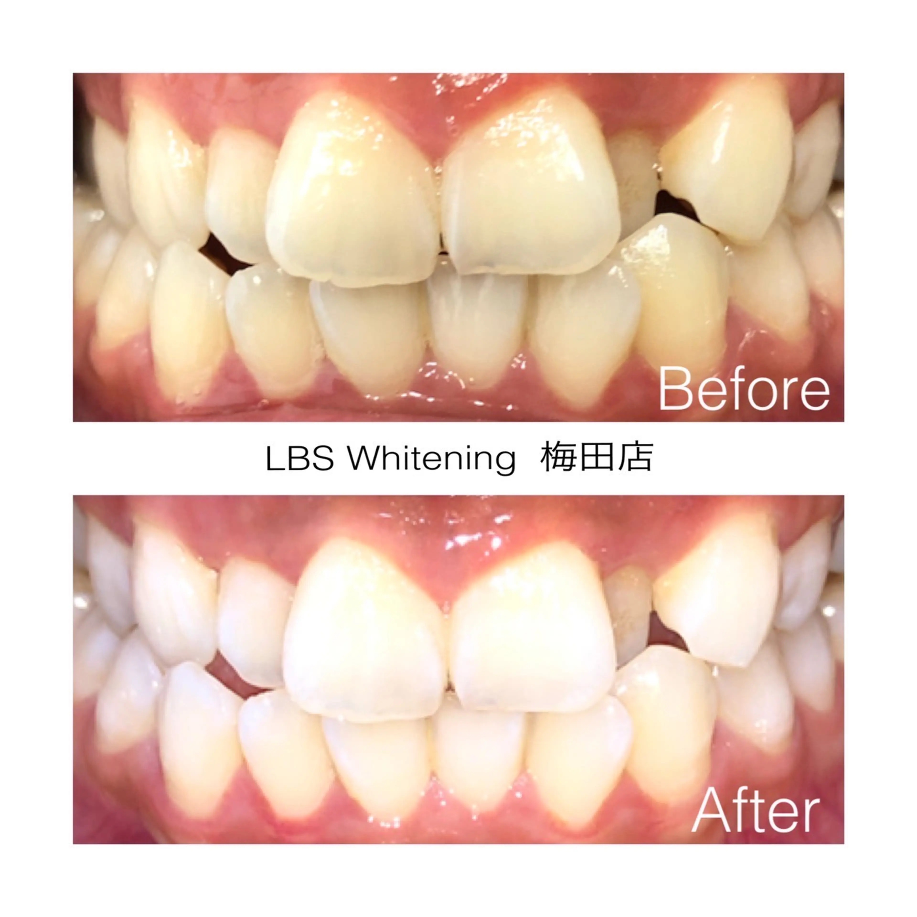 LBSホワイトニング梅田店の内観・外観3