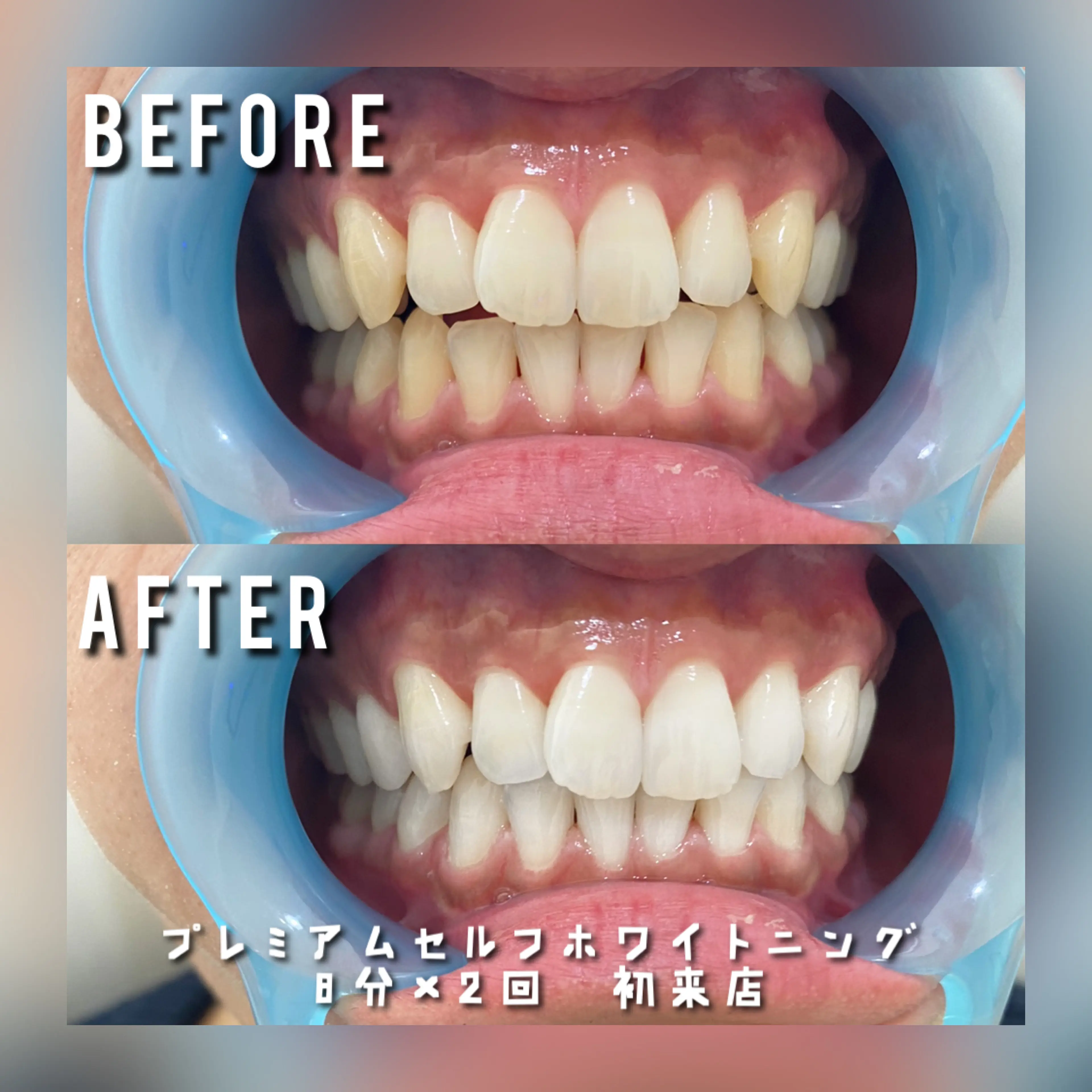 脱毛・セルフホワイトニングSALON STELLAの内観・外観3