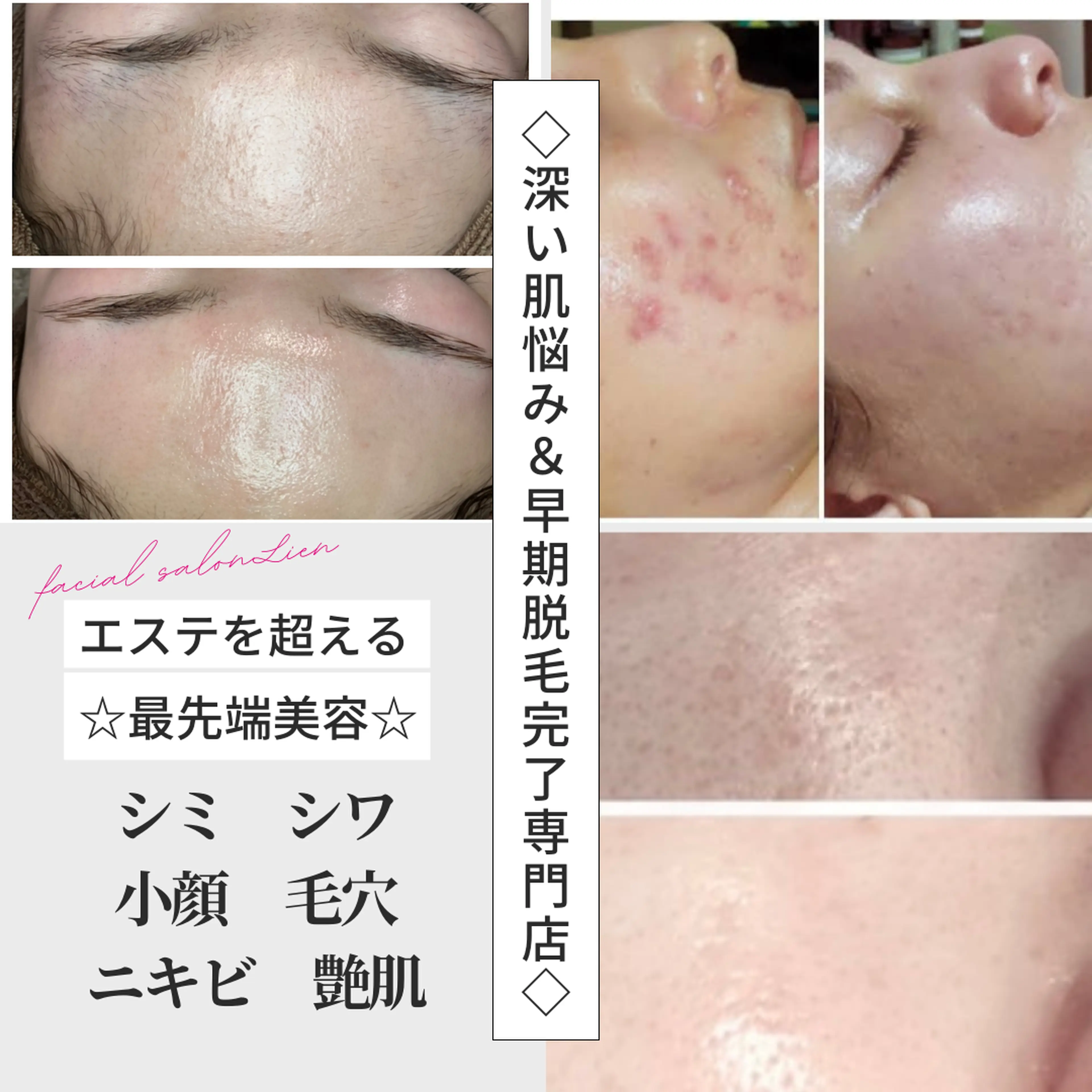 Lienの内観・外観2