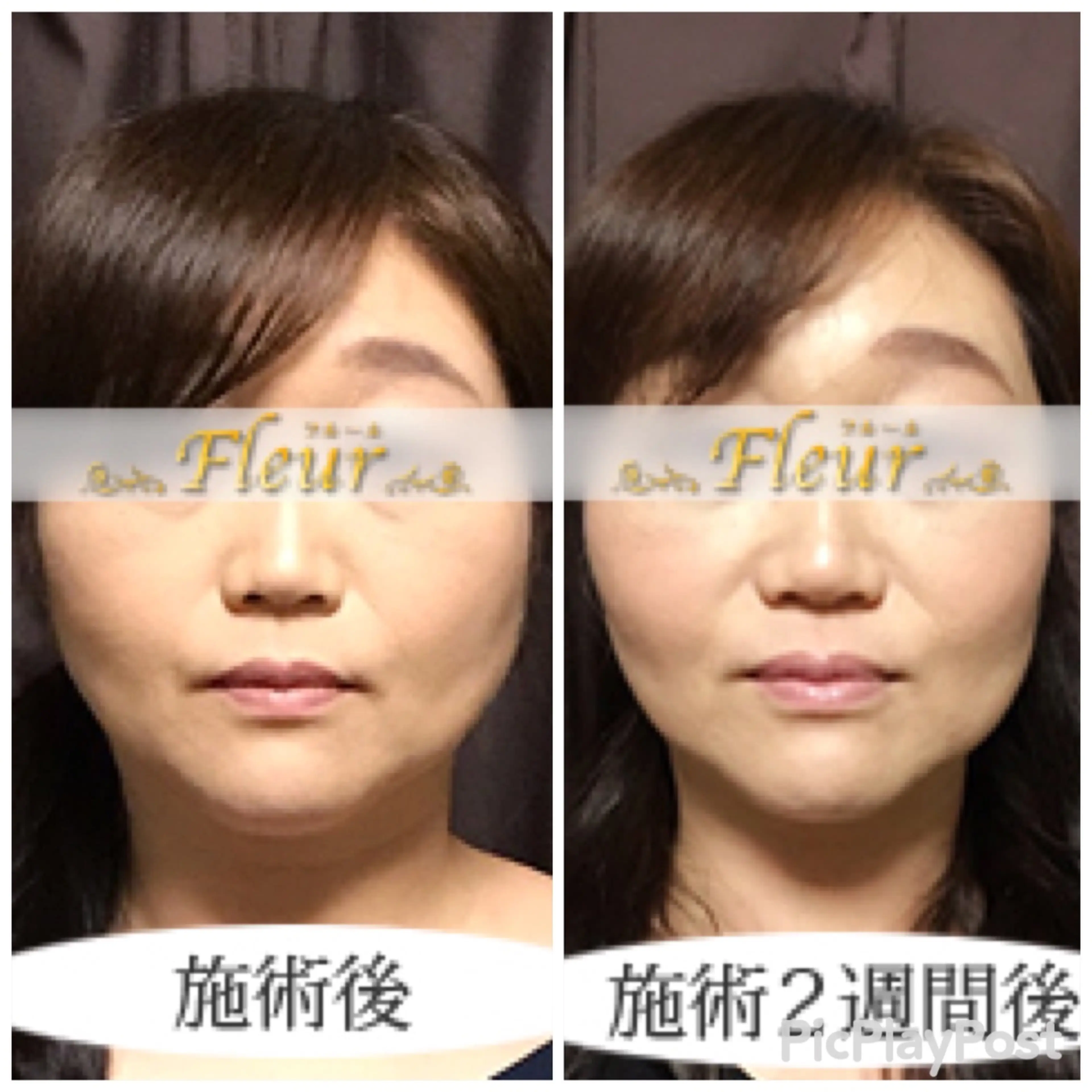 Faceline fleurの内観・外観3