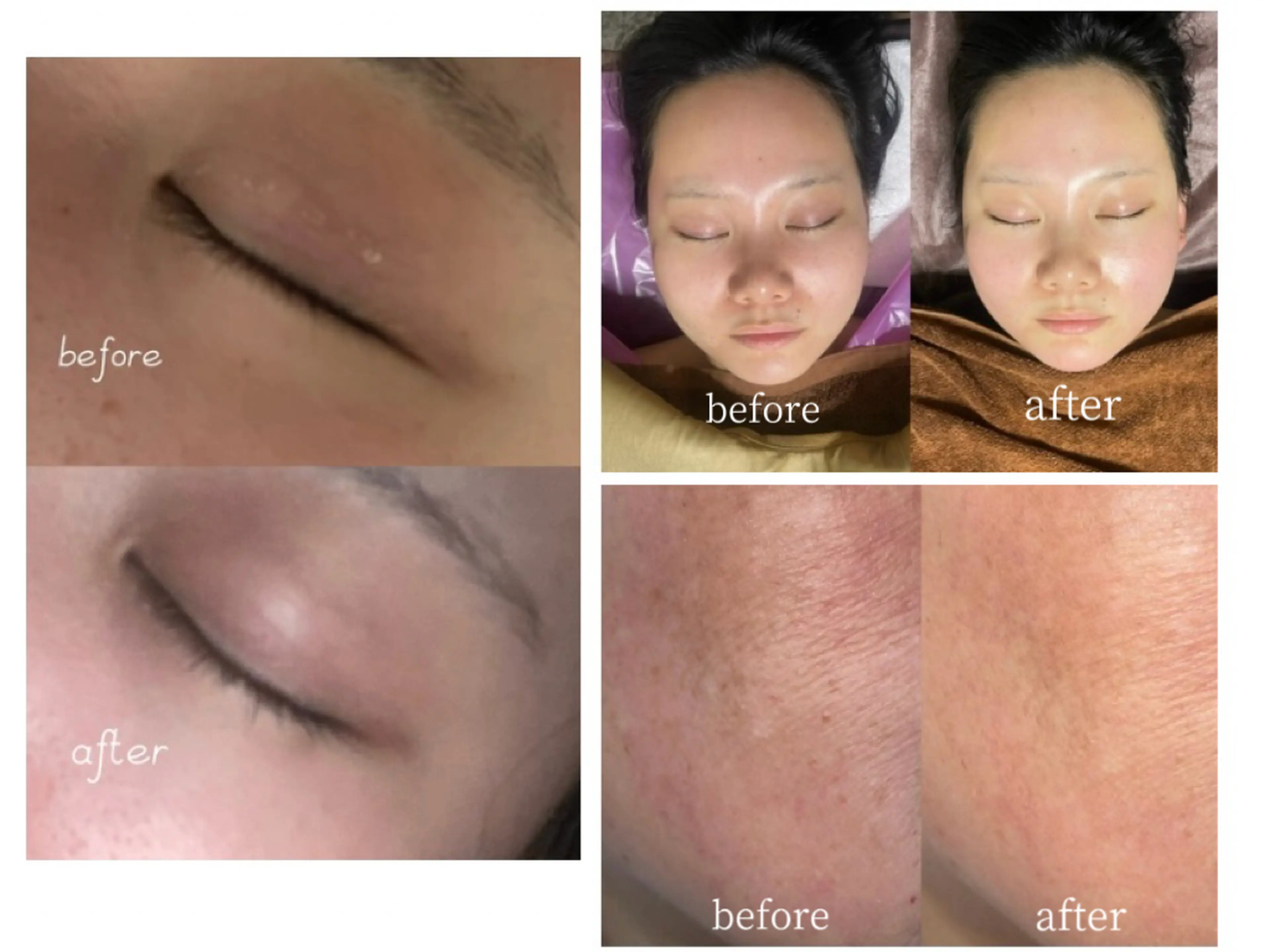 kiraraの内観・外観2