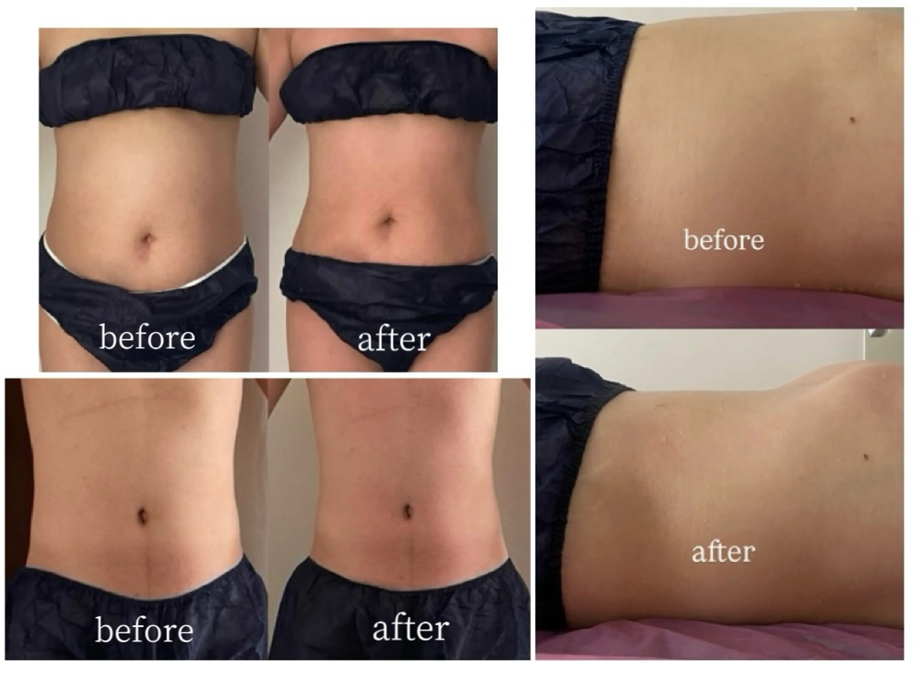 kiraraの内観・外観3