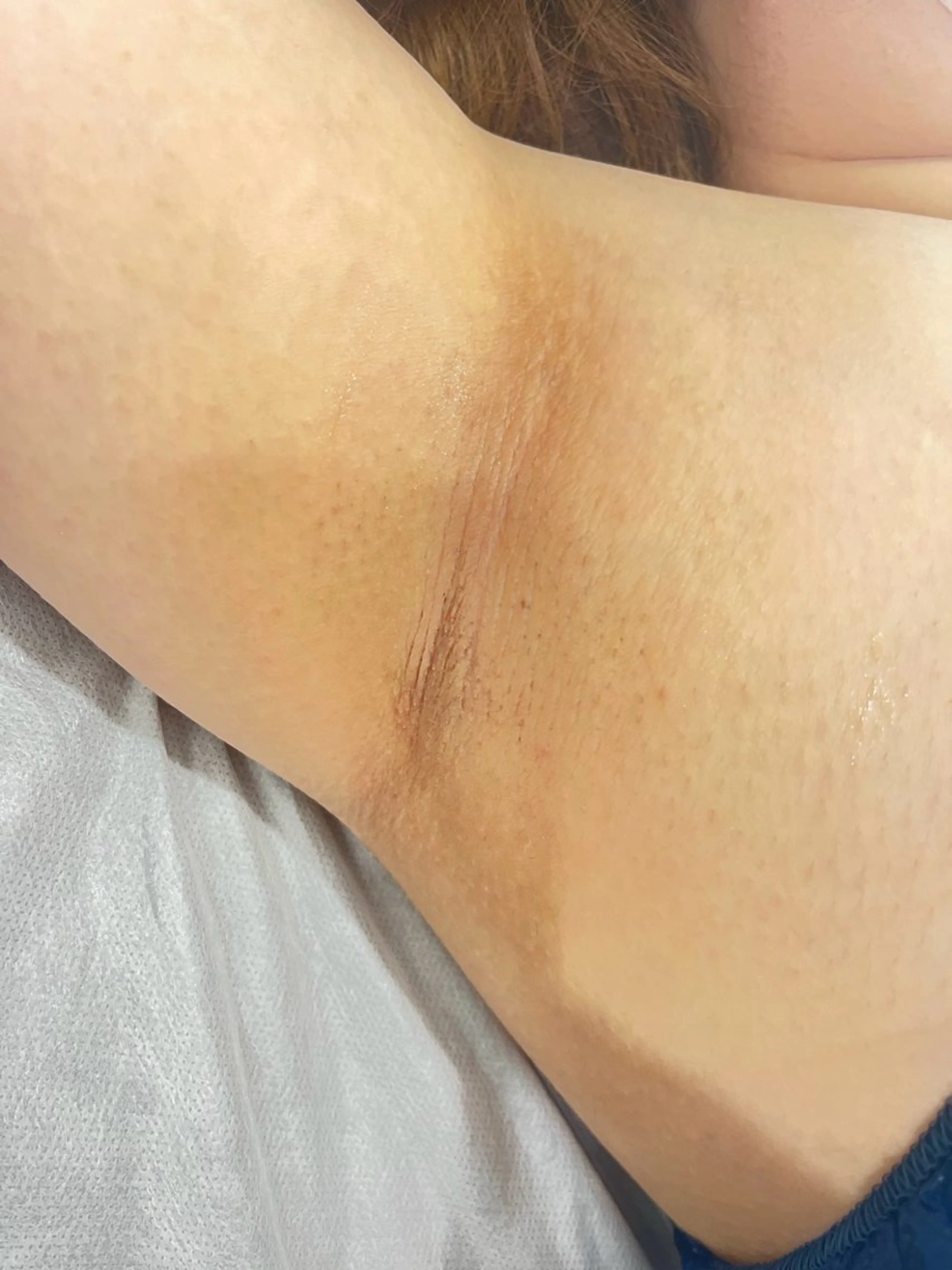 salonvilla所属・villa ☺︎草山 楓花のエステ・リラクイメージ