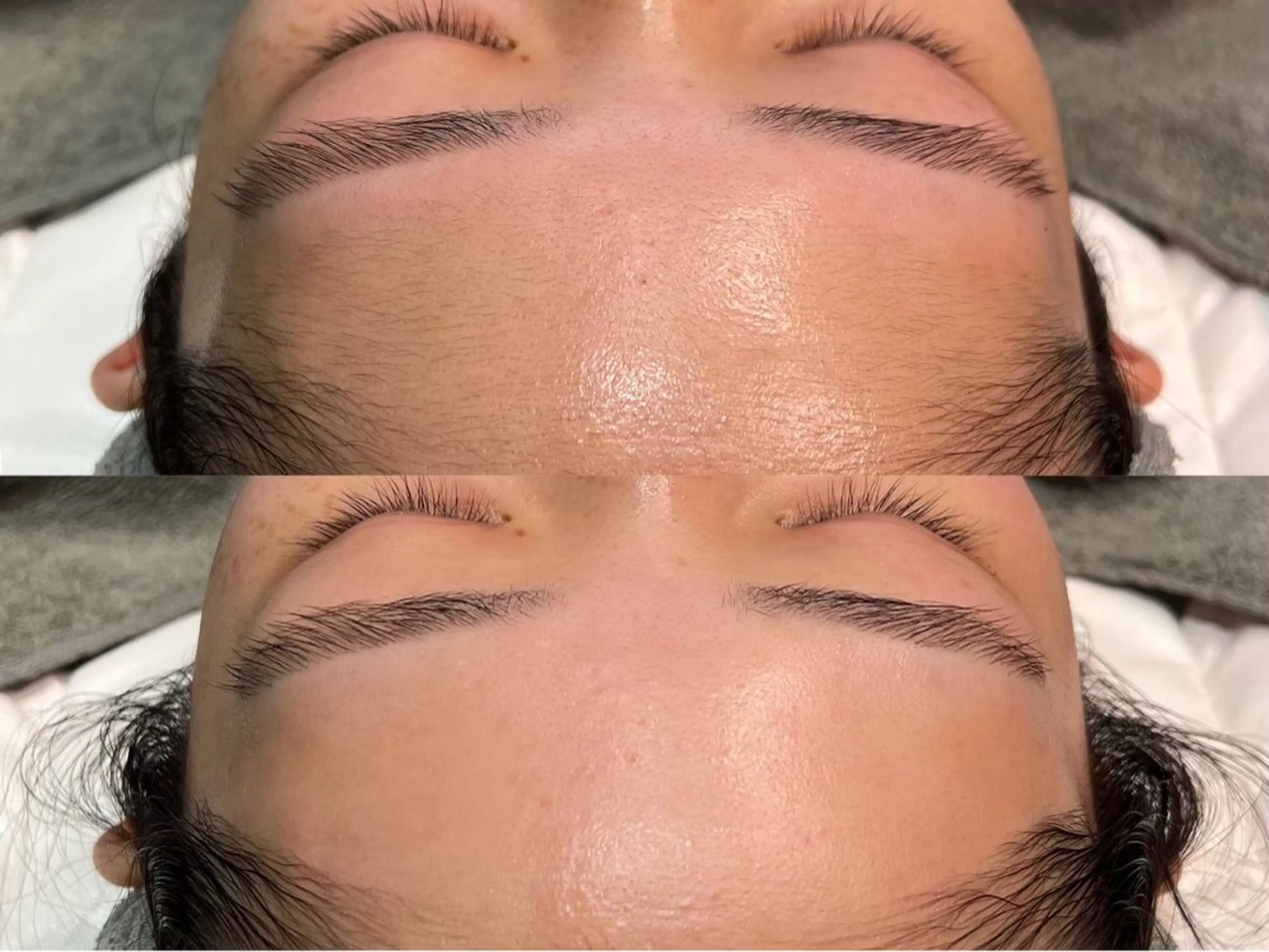 フルフェイスWAX顔脱毛×贅沢パック✨の写真