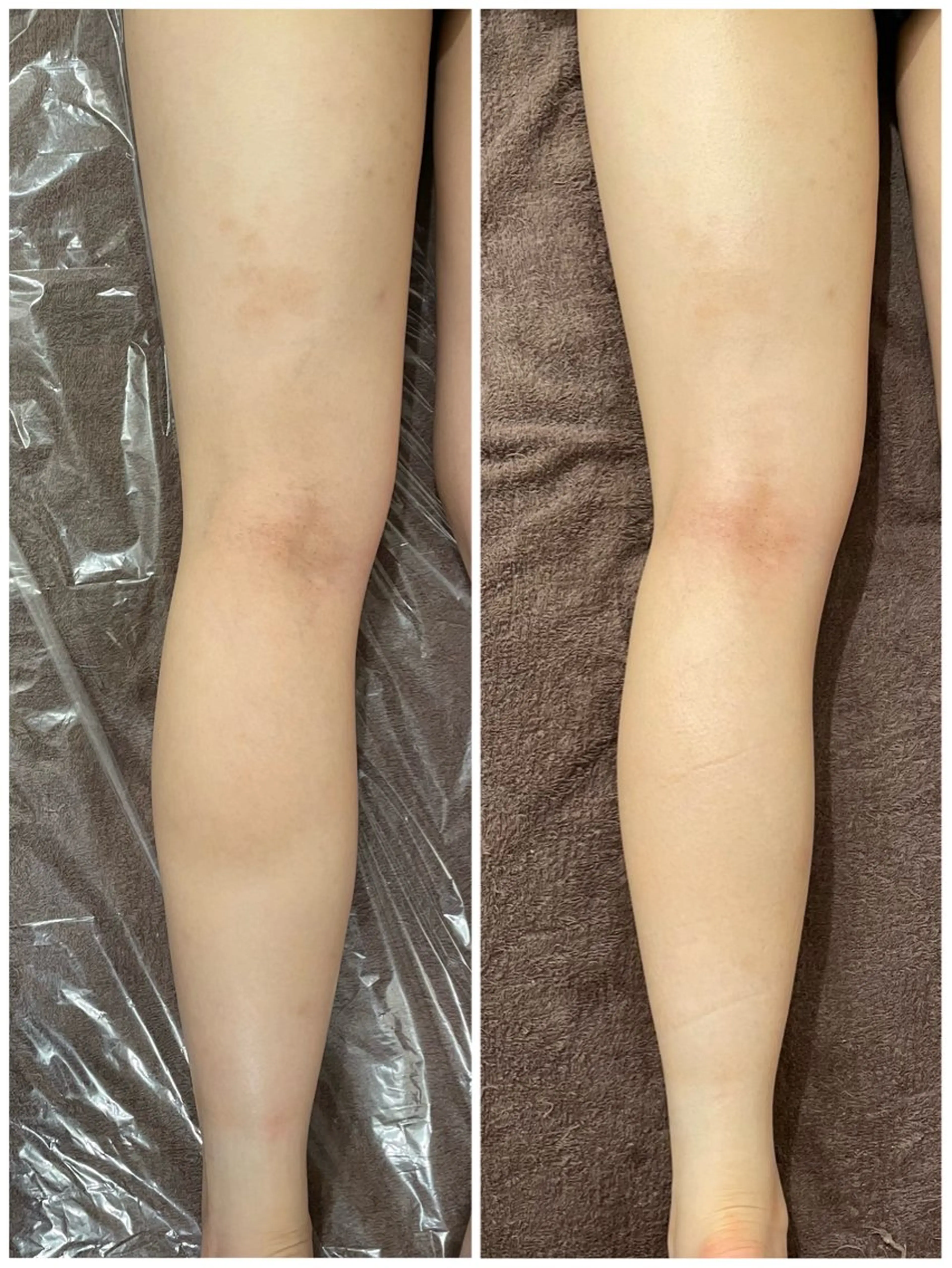 ミニモ限定🩵２０代女性限定【全身マッサージのエステ】PMSや肩こりや冷え性が気になる方にも🌿男性不可ですの写真