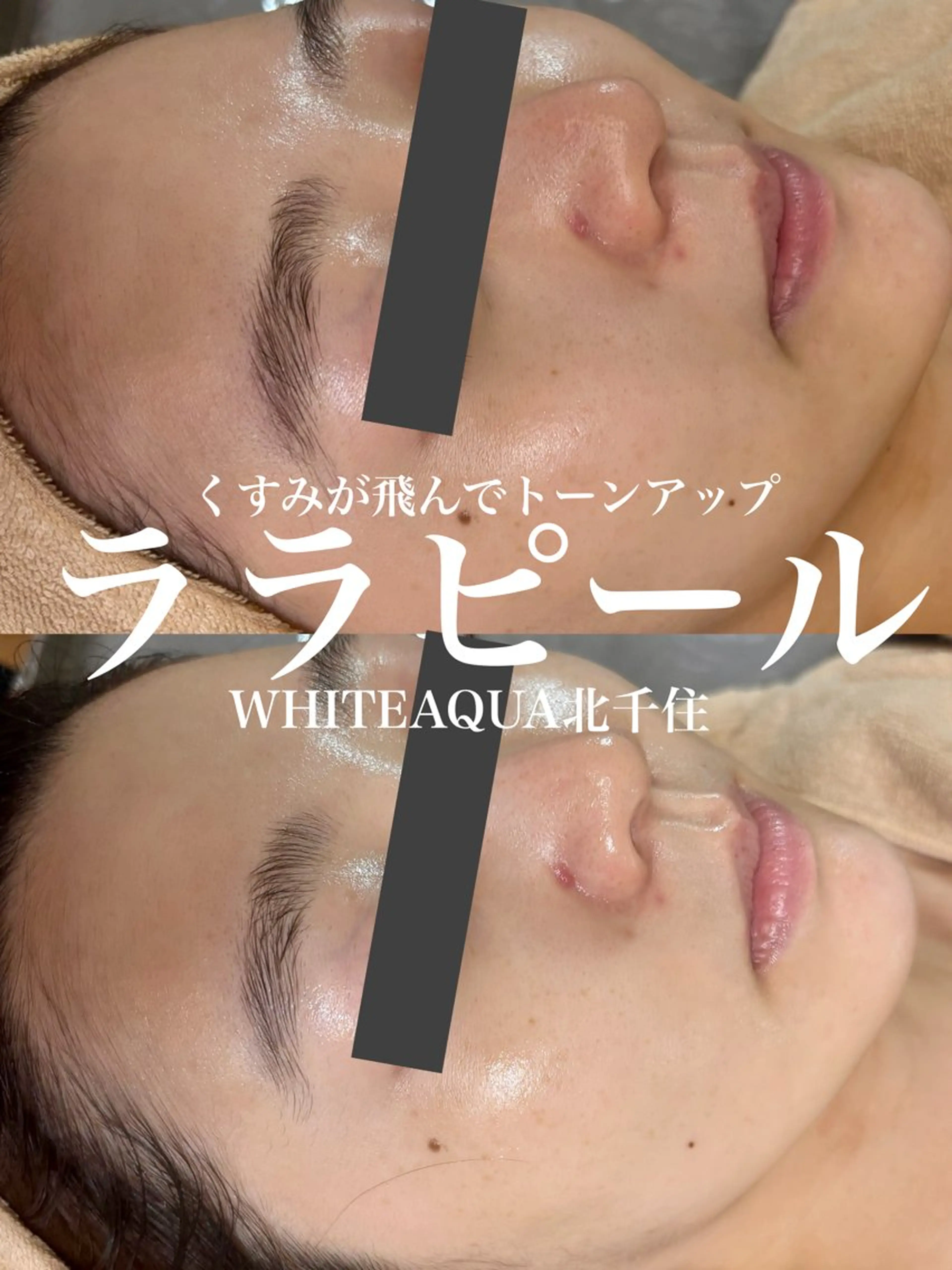 エステ WHITE AQUA 北千住店のエステ・リラクイメージ