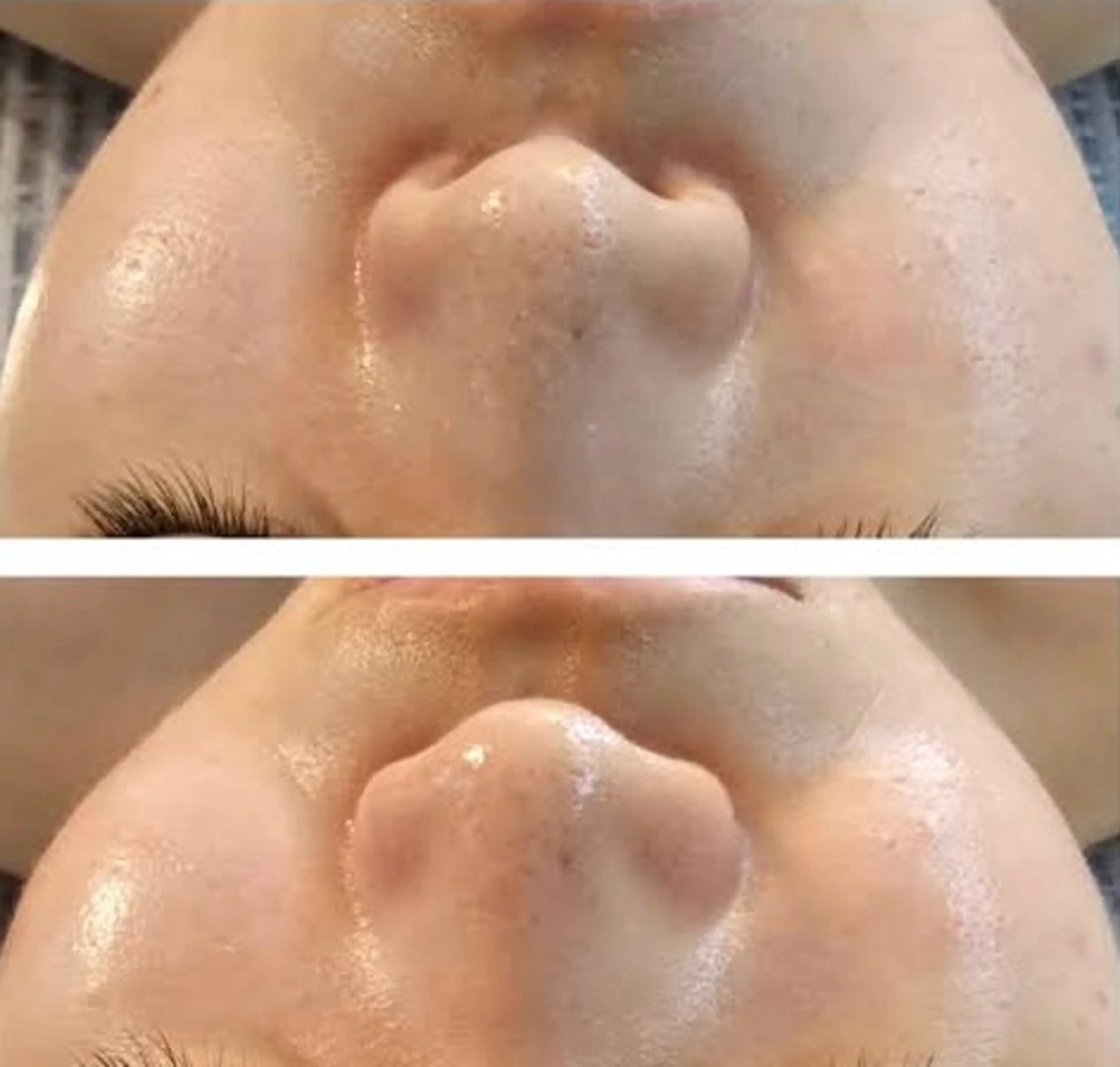 韓国水光肌♡光フェイシャルエステ♡たるみ、くすみ、お客様のお肌のお悩みに合わせて。の写真