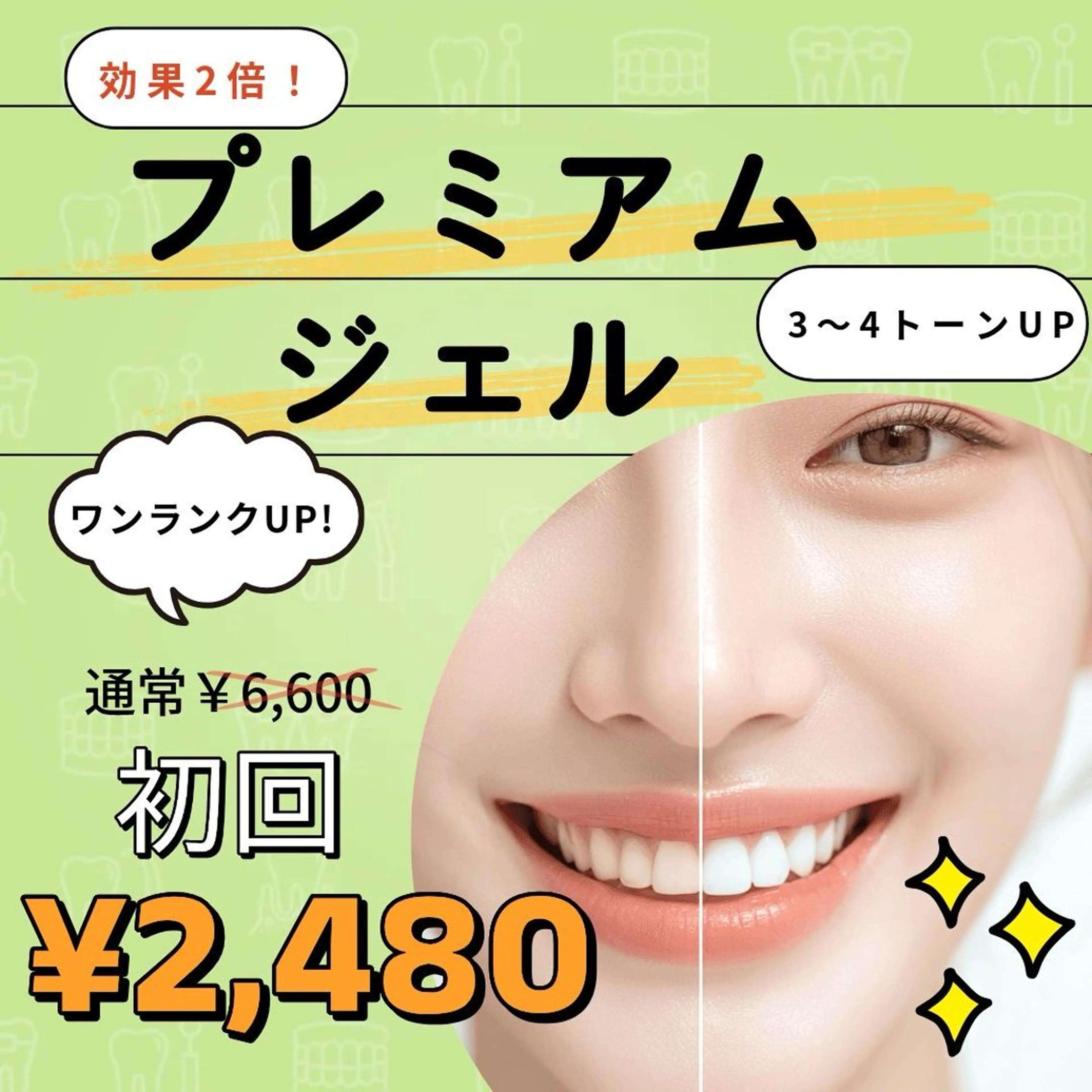 OPEN記念★着色汚れがごっそり落ちる！！最先端ホワイトニングお試しプレミアム1回30分の写真