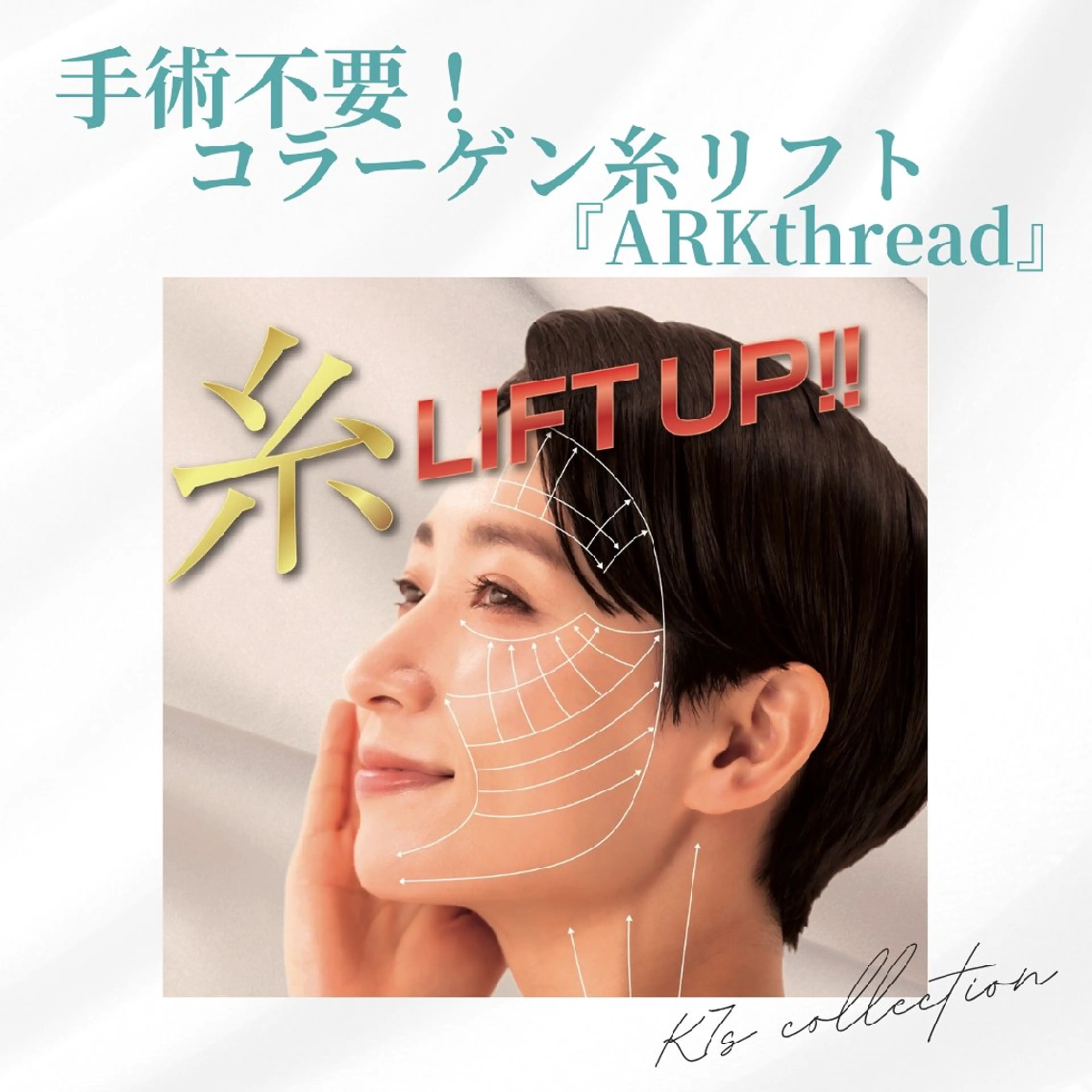新メニュー！切らない糸リフト！糸式美容の吸収糸リフト♡ノンニードルでダウンタイムなし！リフトアップ施術✨️の写真
