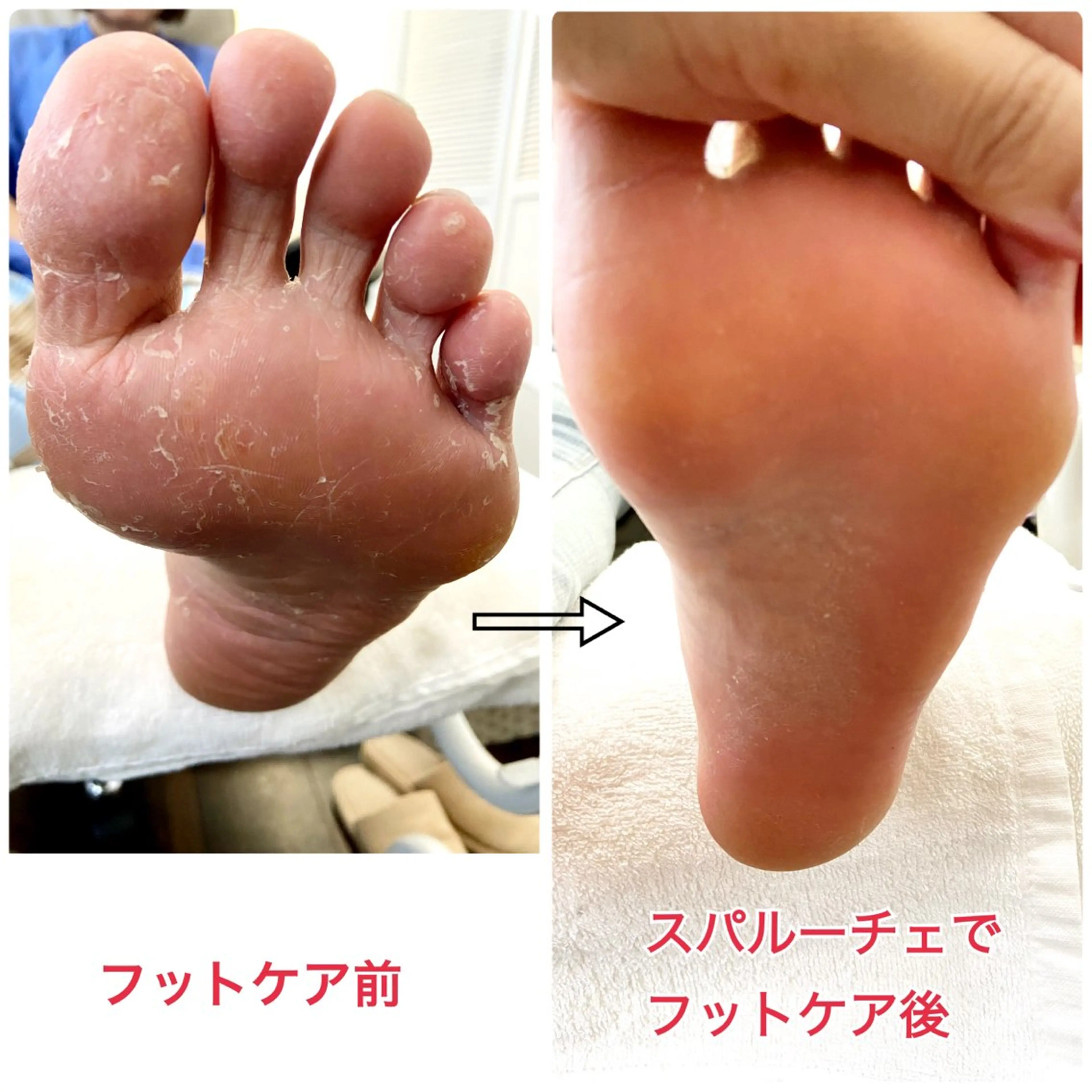 ネイル フットネイル フットネイル Lotus Nailのネイルデザイン