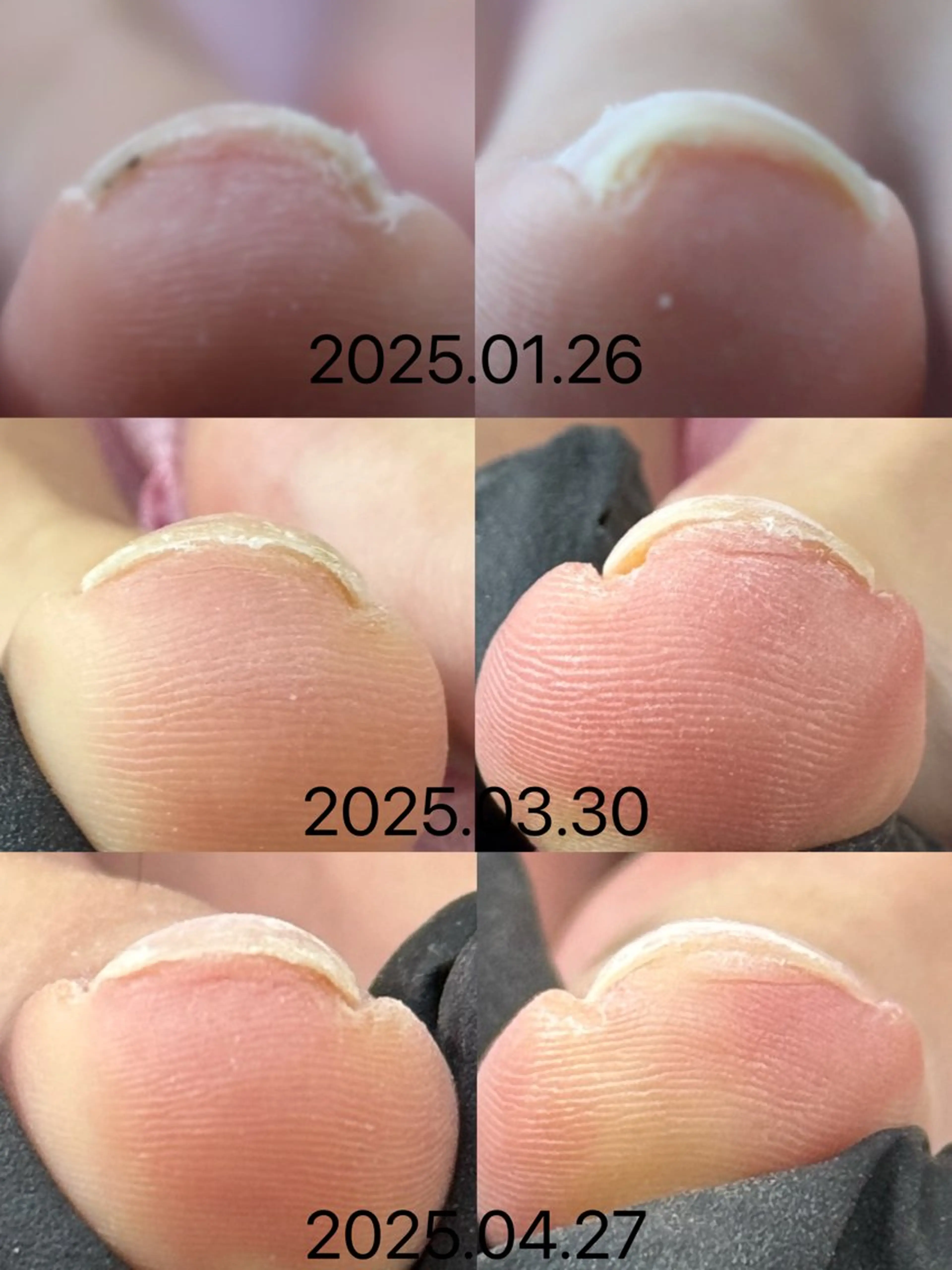 ネイル フットネイル ERINA ♥のネイルデザイン