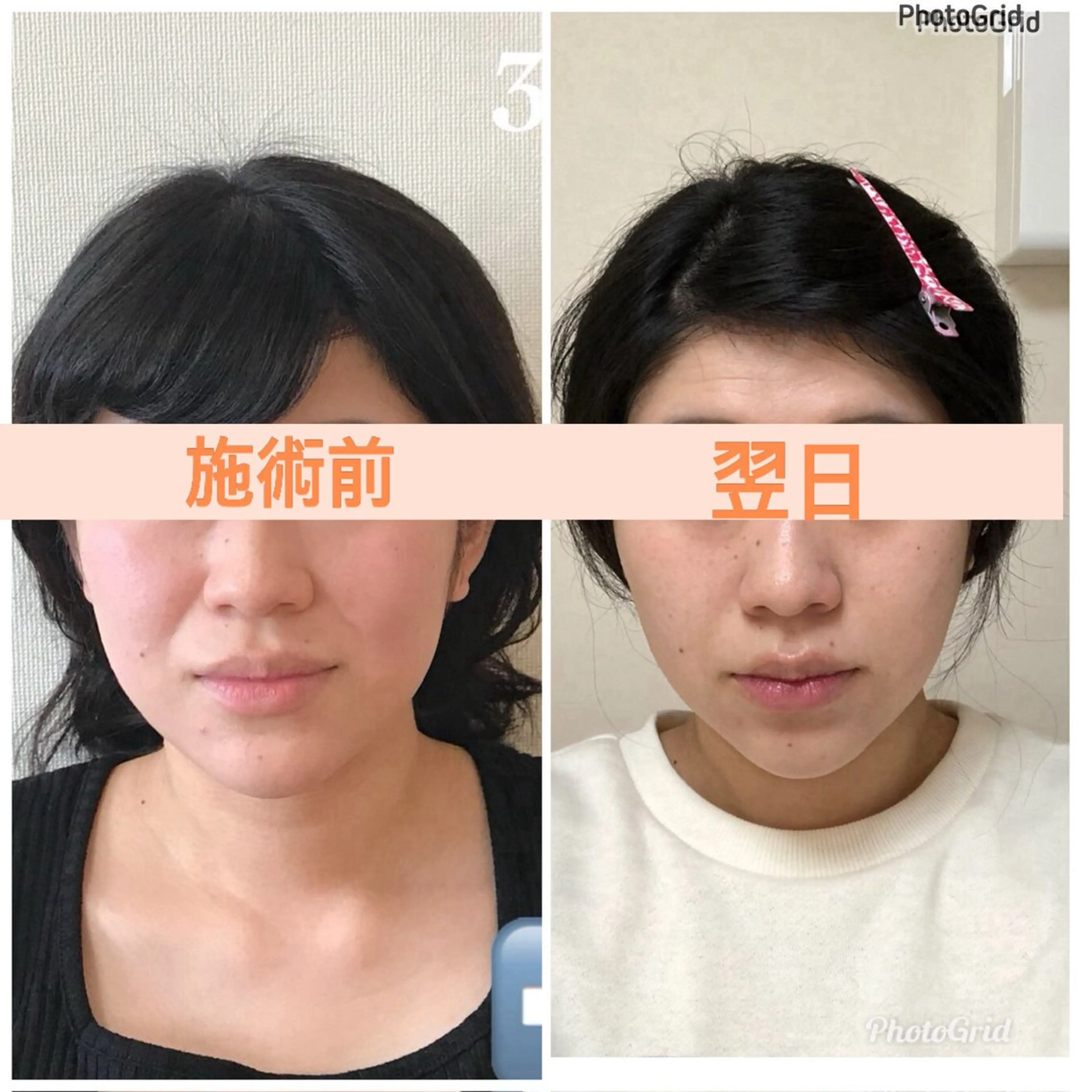 小顔矯正サロン　ReFace Fusae（リフェイスフサエ）所属・小顔矯正サロン リフェイスフサエのエステ・リラクイメージ
