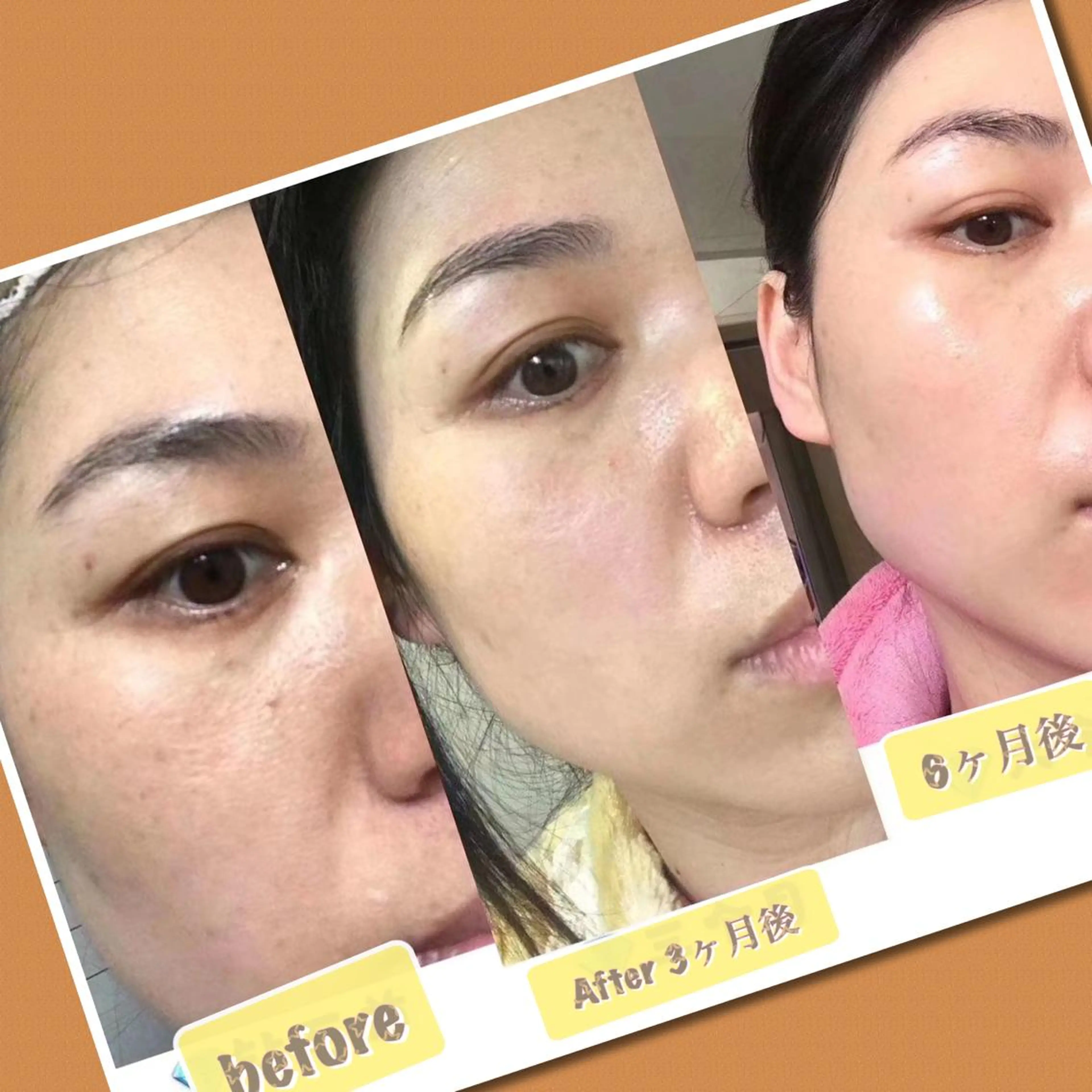 【ハイパーナイフ痩身&小顔コルギ&ハーブピーリング】K-Beauty　東新宿所属・kーbeauty痩身 フェイシャルのエステ・リラクイメージ