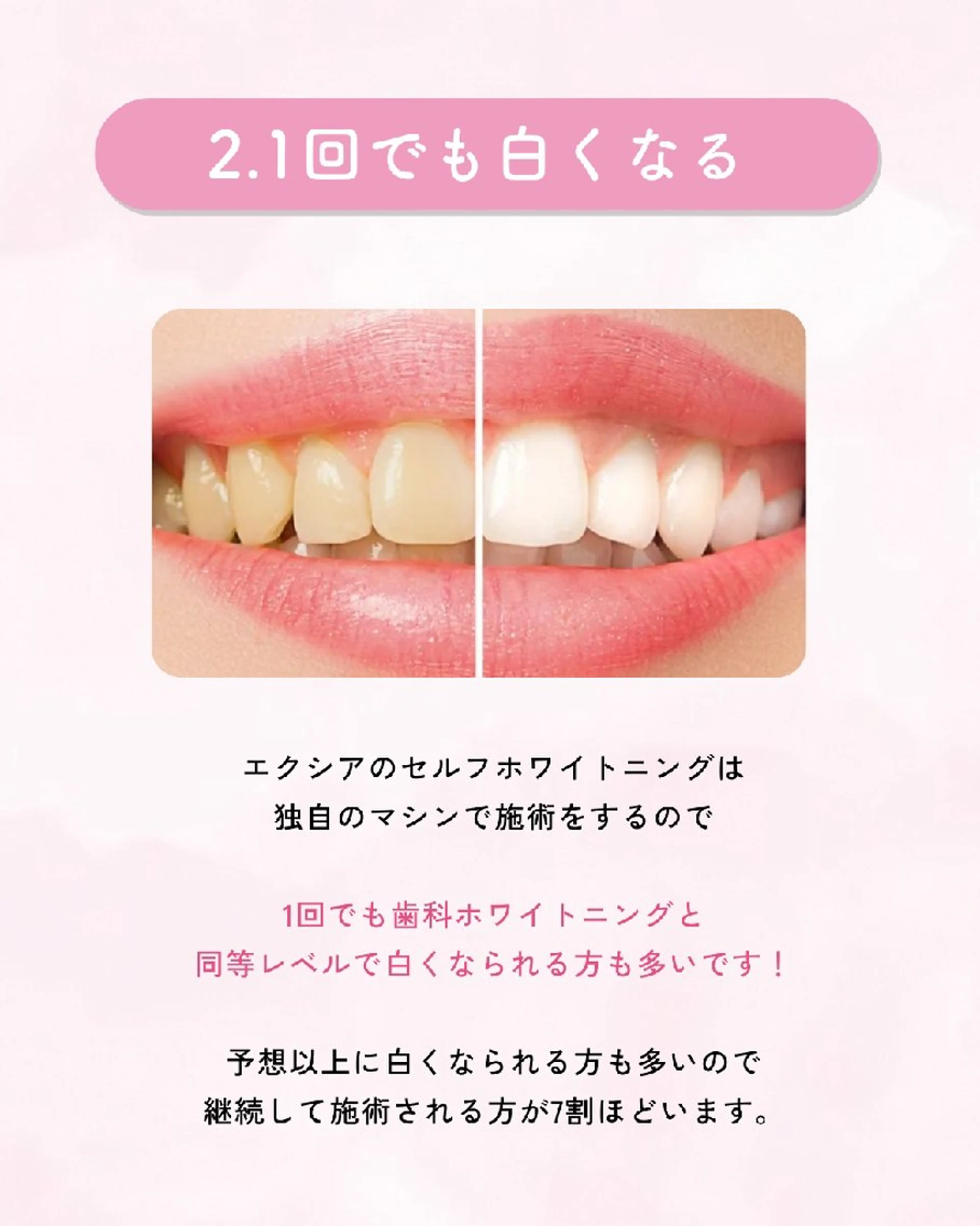その他 エクシアホワイトニング伊勢店所属・セルフホワイトニング エクシア伊勢店のその他イメージ