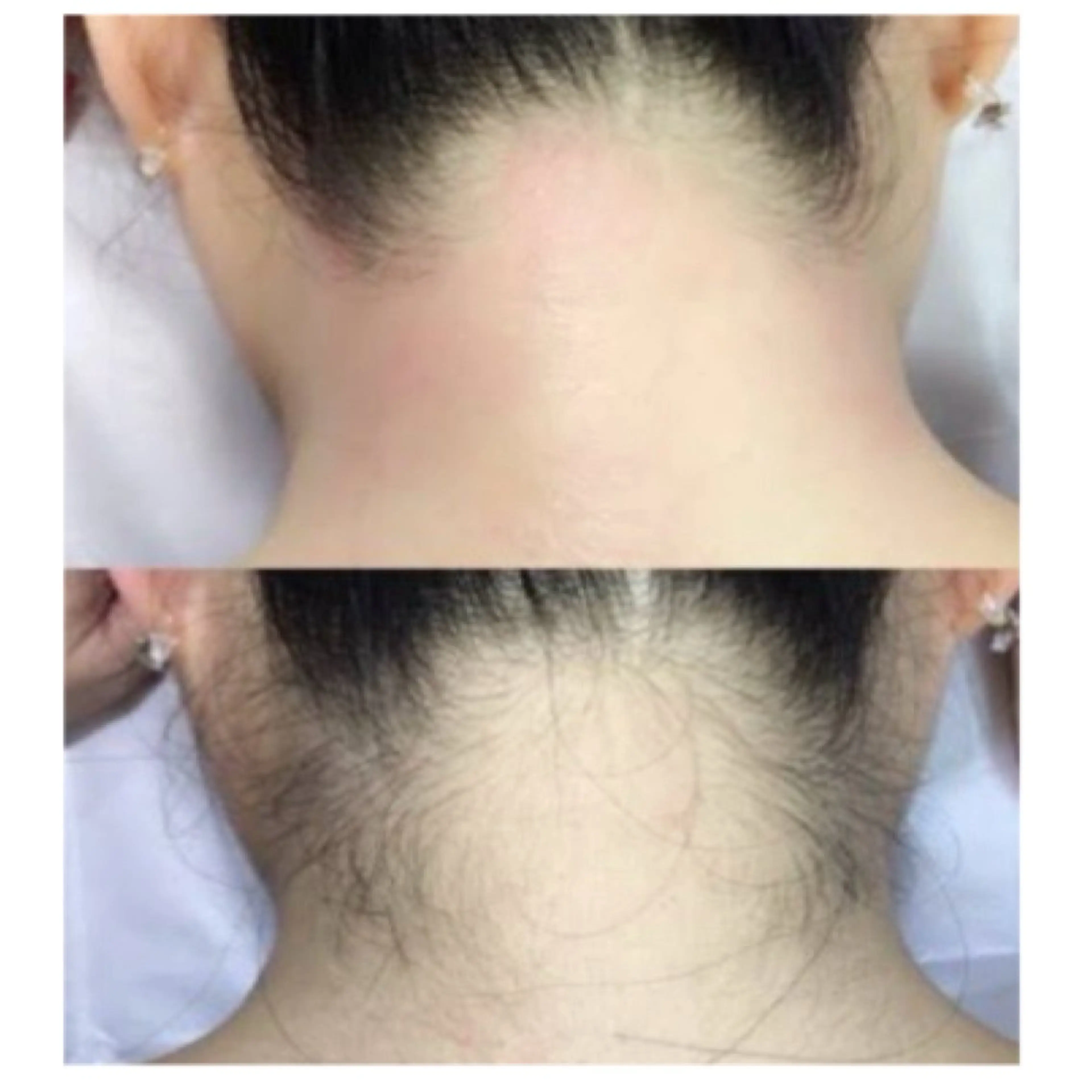 脱毛 private salon tete所属・private salonteteのネイルデザイン