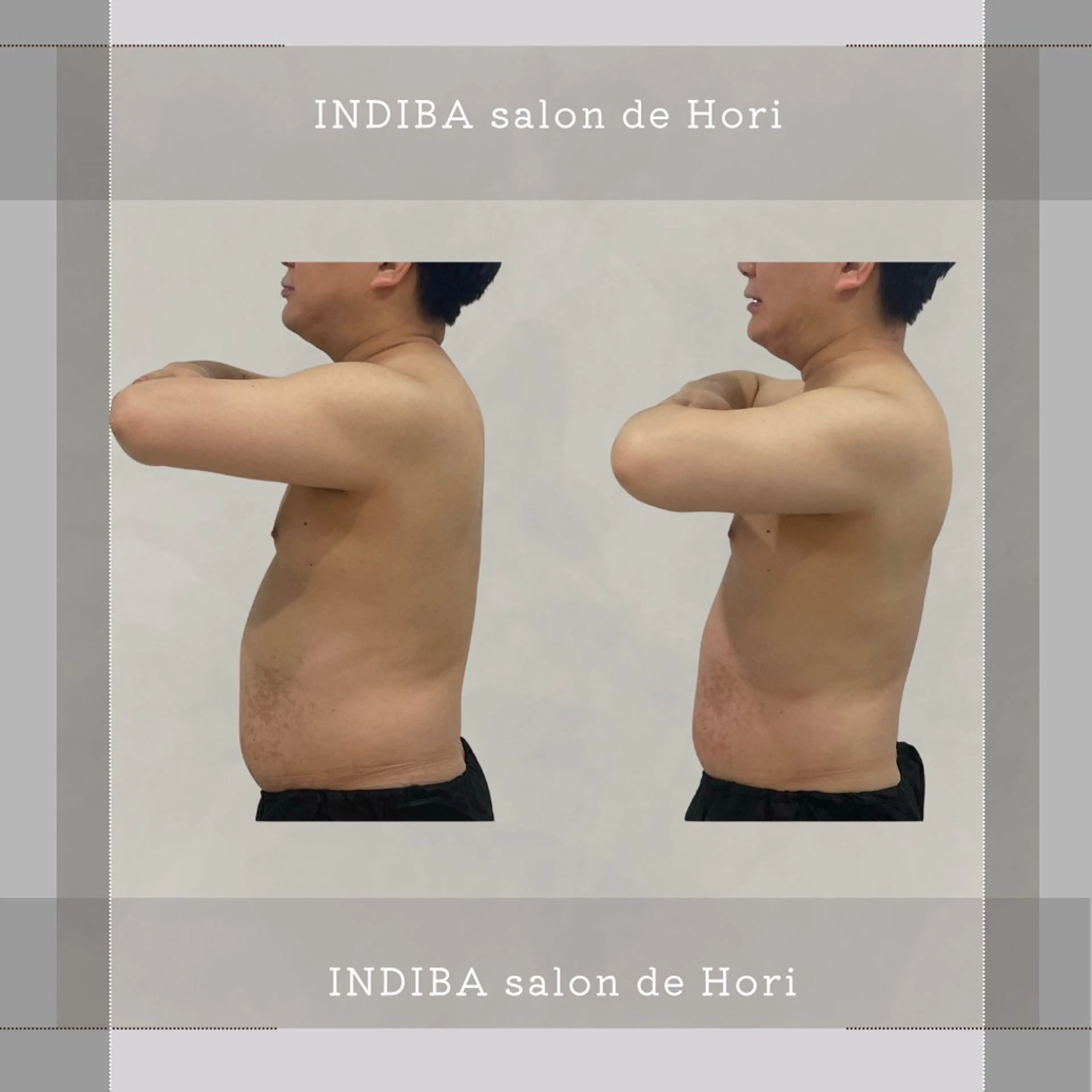 メンズ INDIBA Salon小澤るいのエステ・リラクイメージ