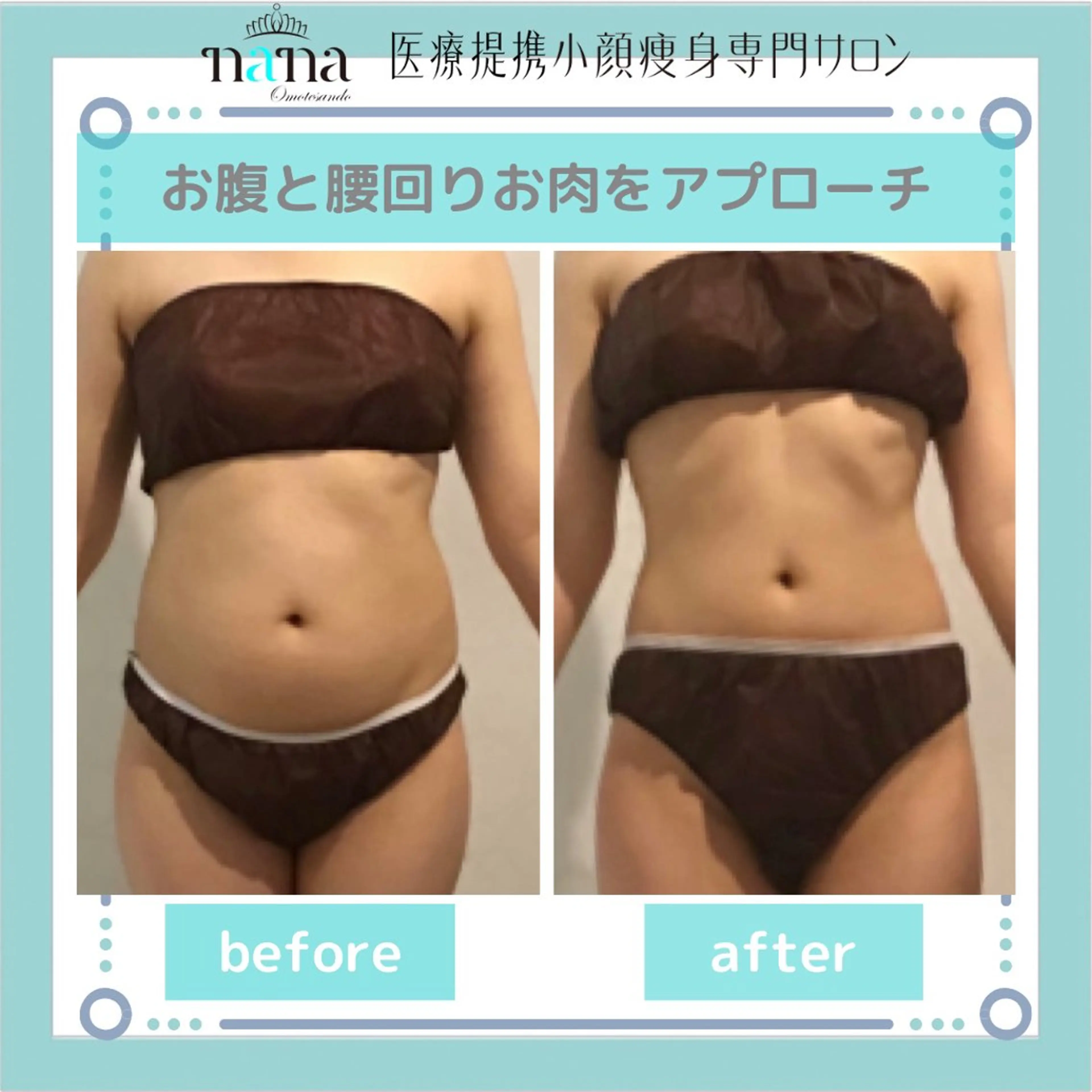 小顔痩身インディバ Nana表参道のエステ・リラクイメージ