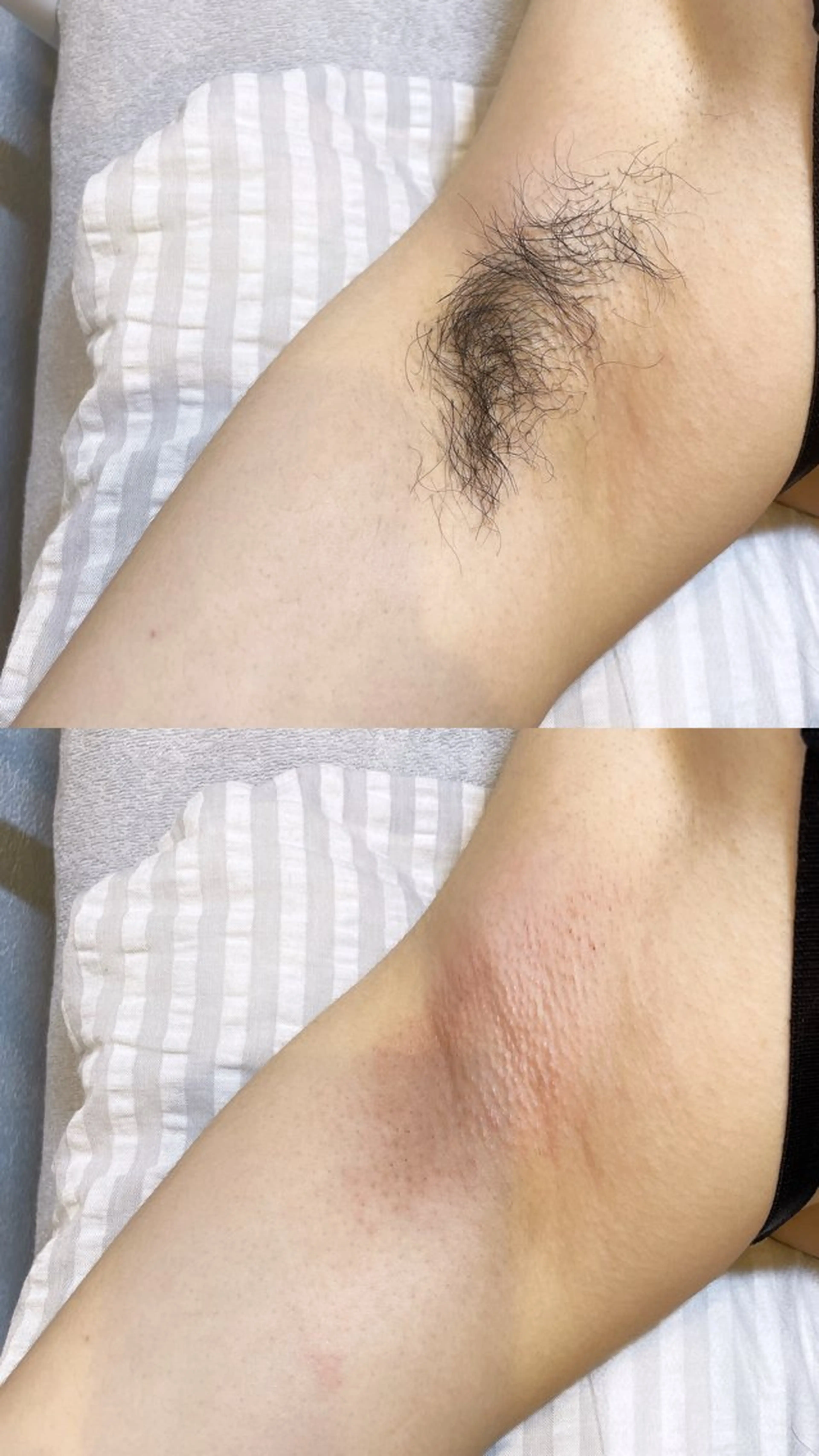 VIO脱毛専門店 kika〜キカ〜所属・【メンズSTART】 VIO専門店kikaのエステ・リラクイメージ