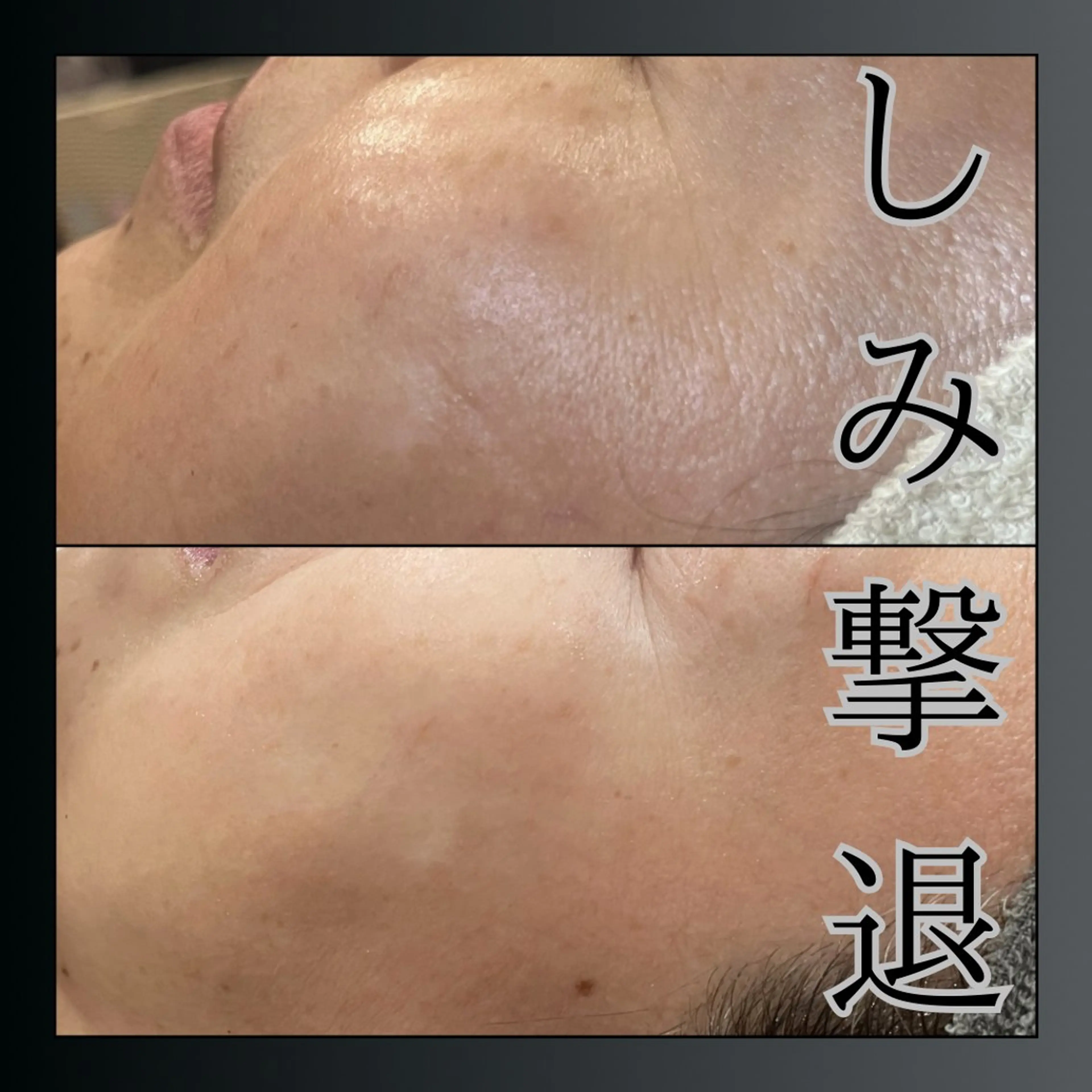 LiZA エステティックサロンのエステ・リラクイメージ