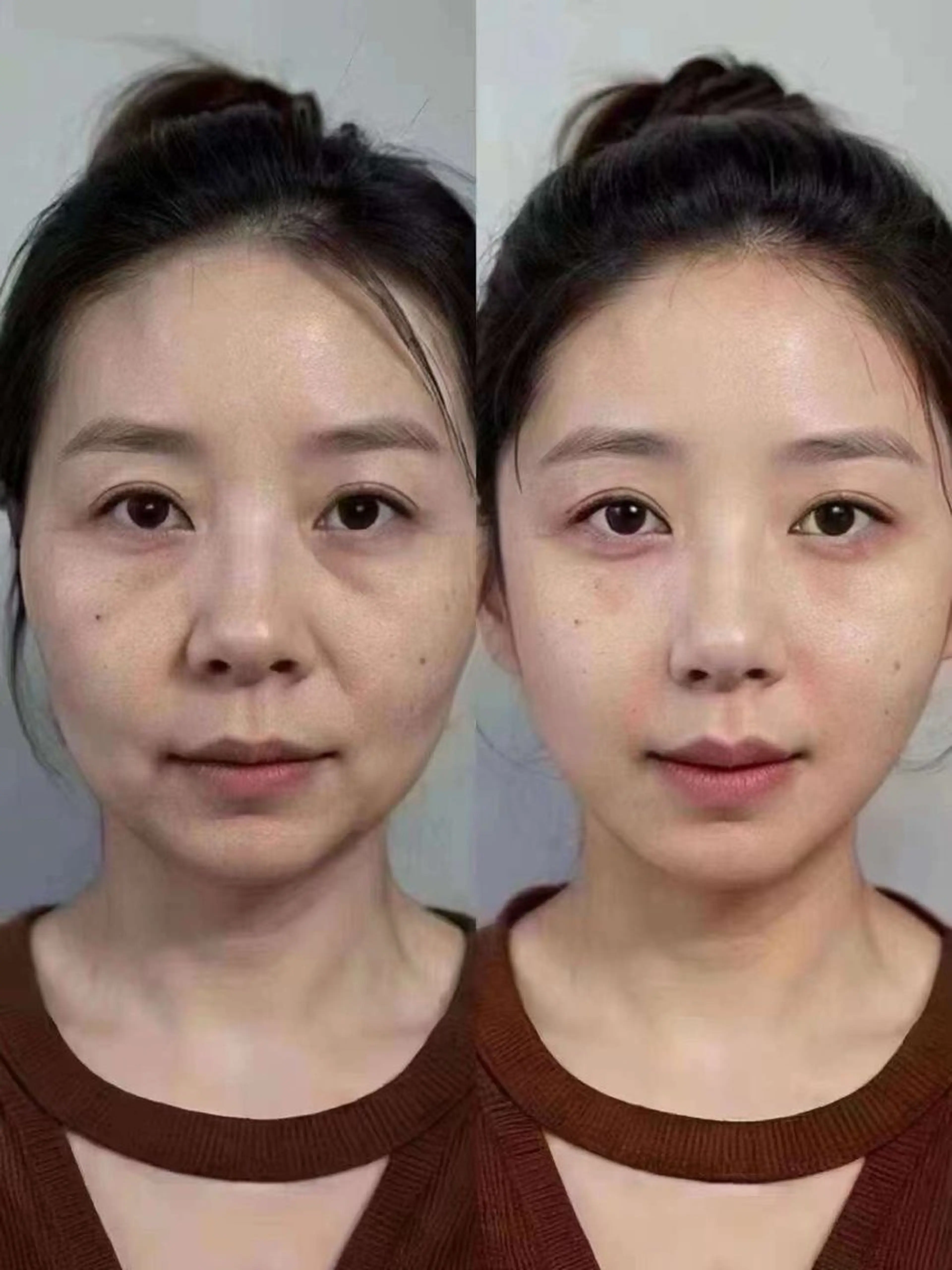 マツエク・マツパ エステ aliaハイフ&水光ジェットサロン所属・aliaハーブ水光店 エステティシャン募集のエステ・リラクイメージ