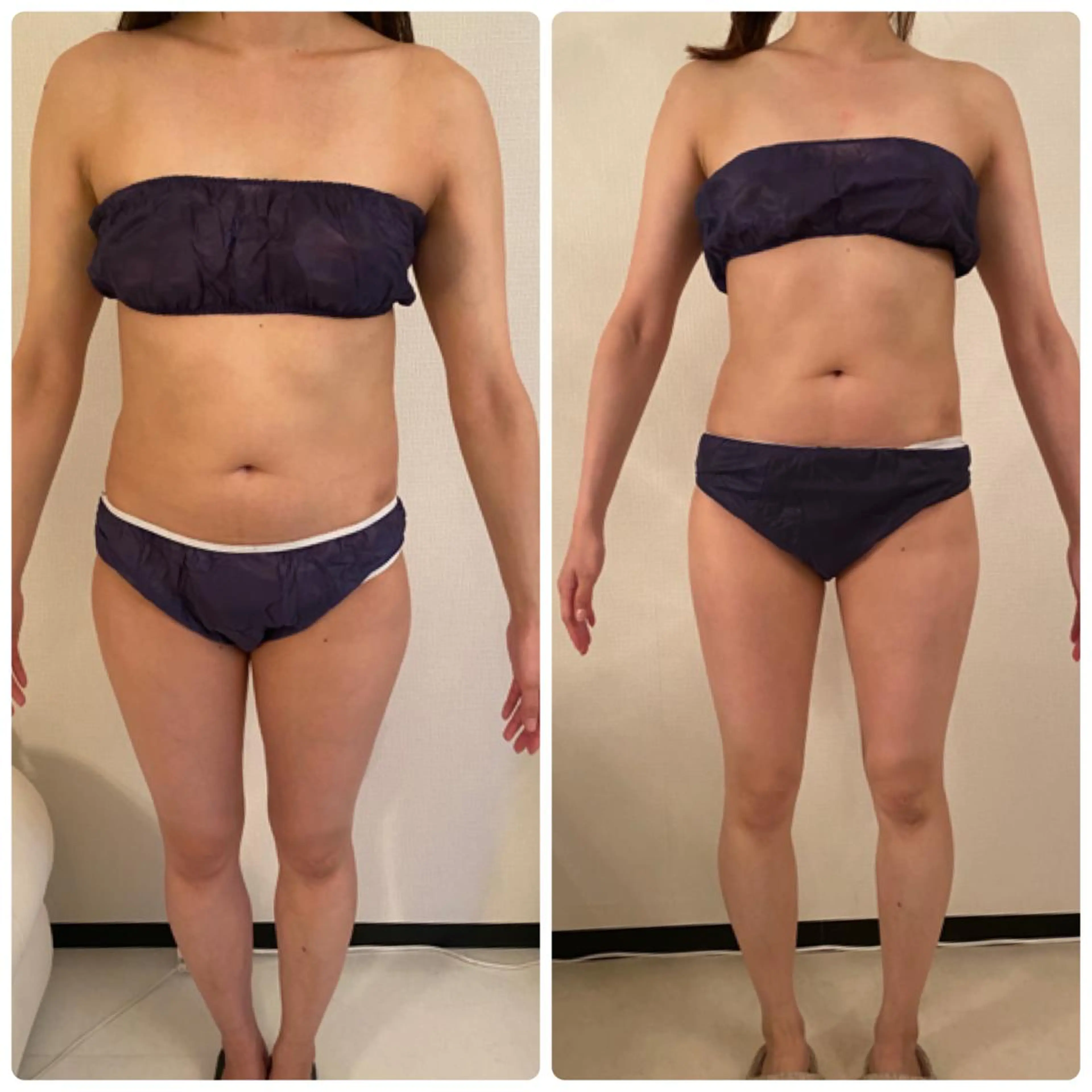 FLEUR大阪・整体 ・ハイフ・痩身・小顔のエステ・リラクイメージ