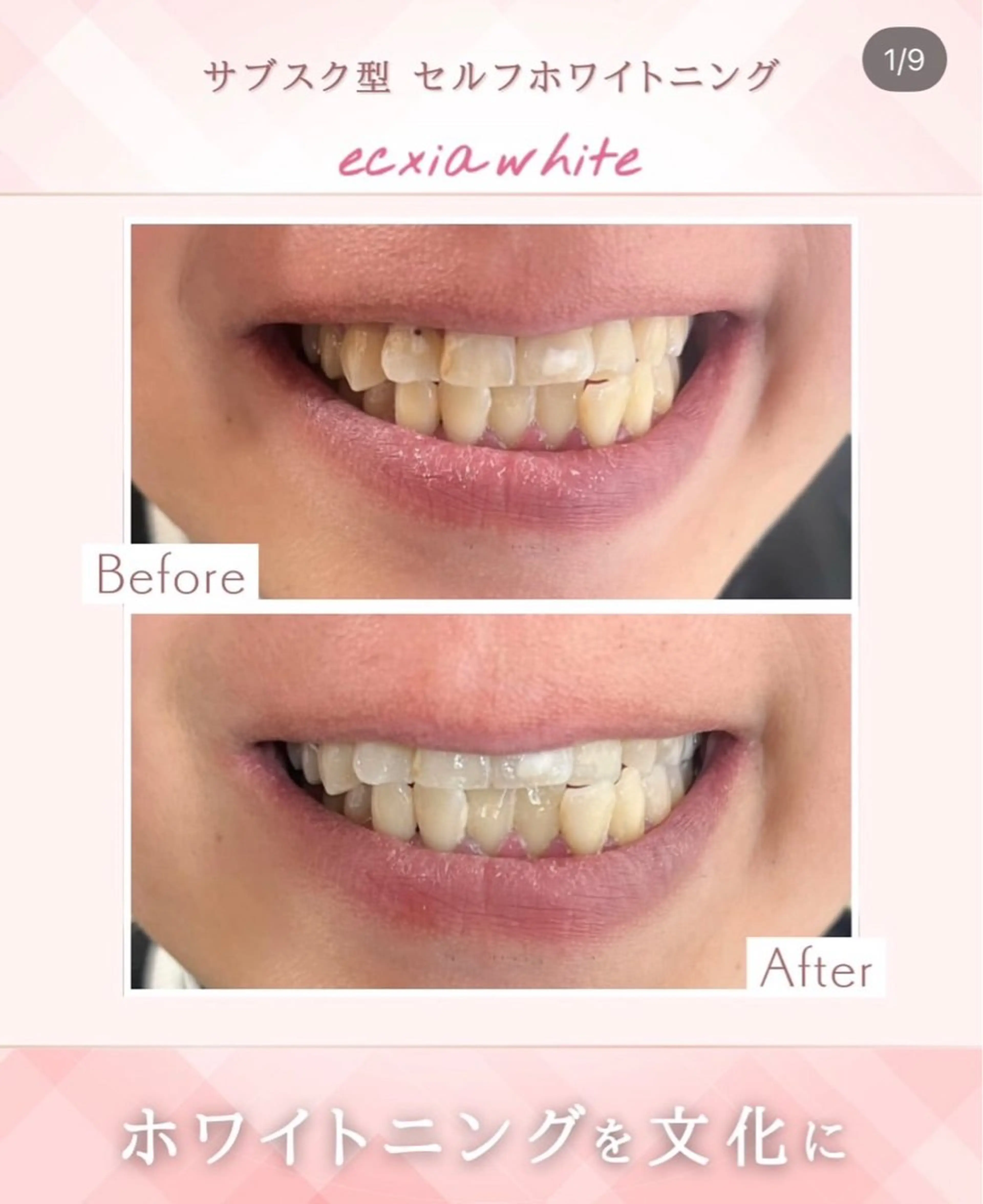 エステ エクシアホワイト 立川南口のエステ・リラクイメージ