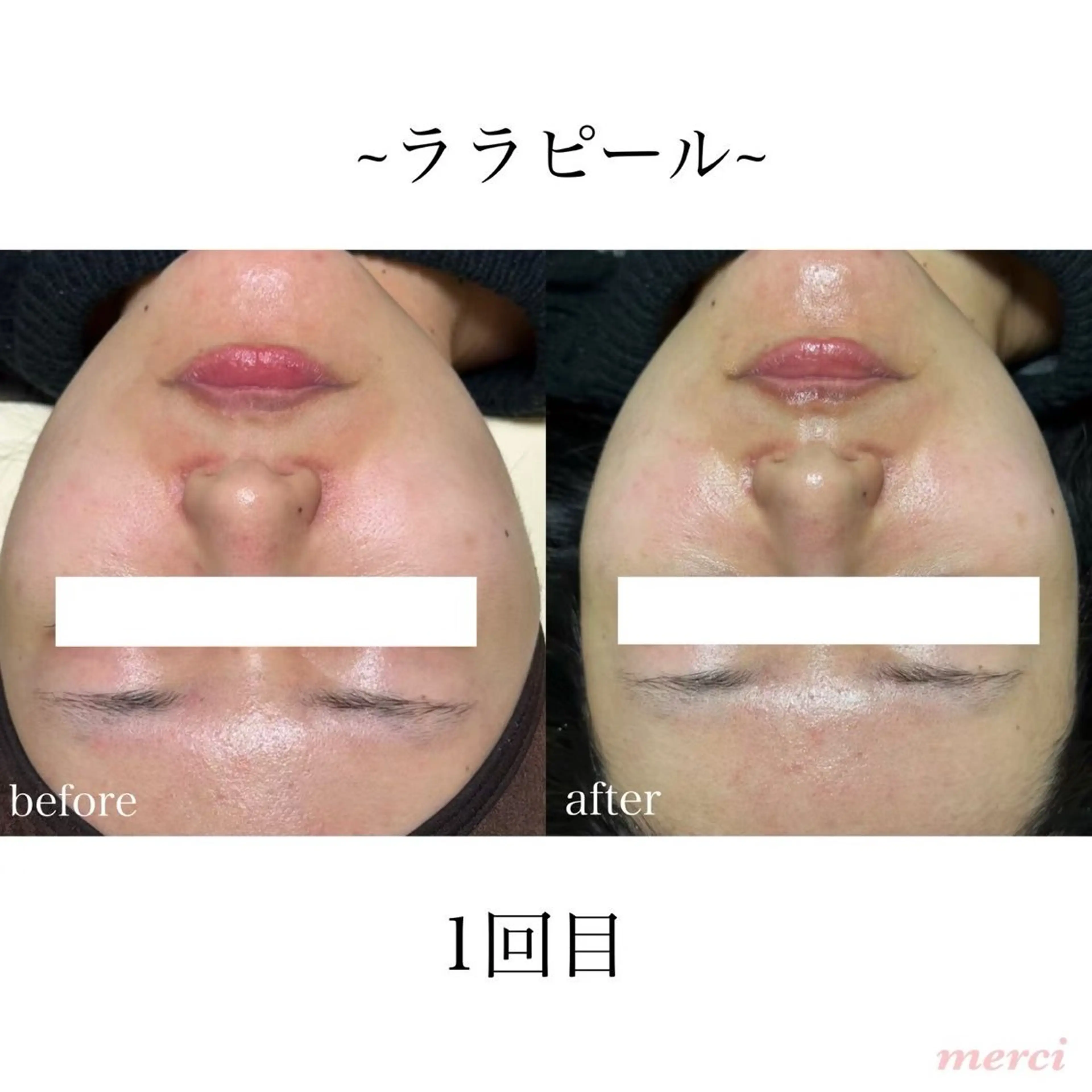 salon merciのエステ・リラクイメージ