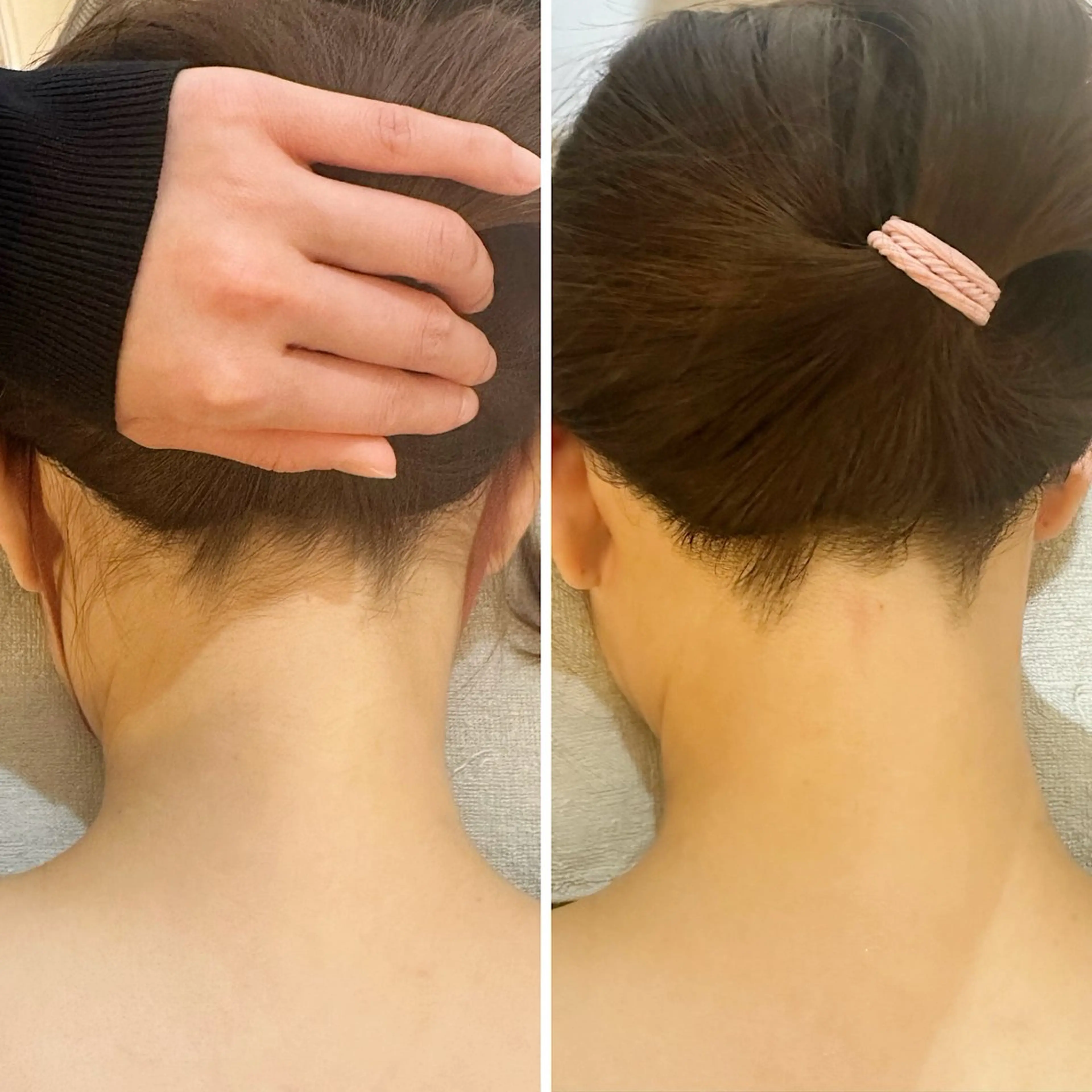 脱毛 うなじ脱毛/美肌脱毛 LABELのエステ・リラクイメージ