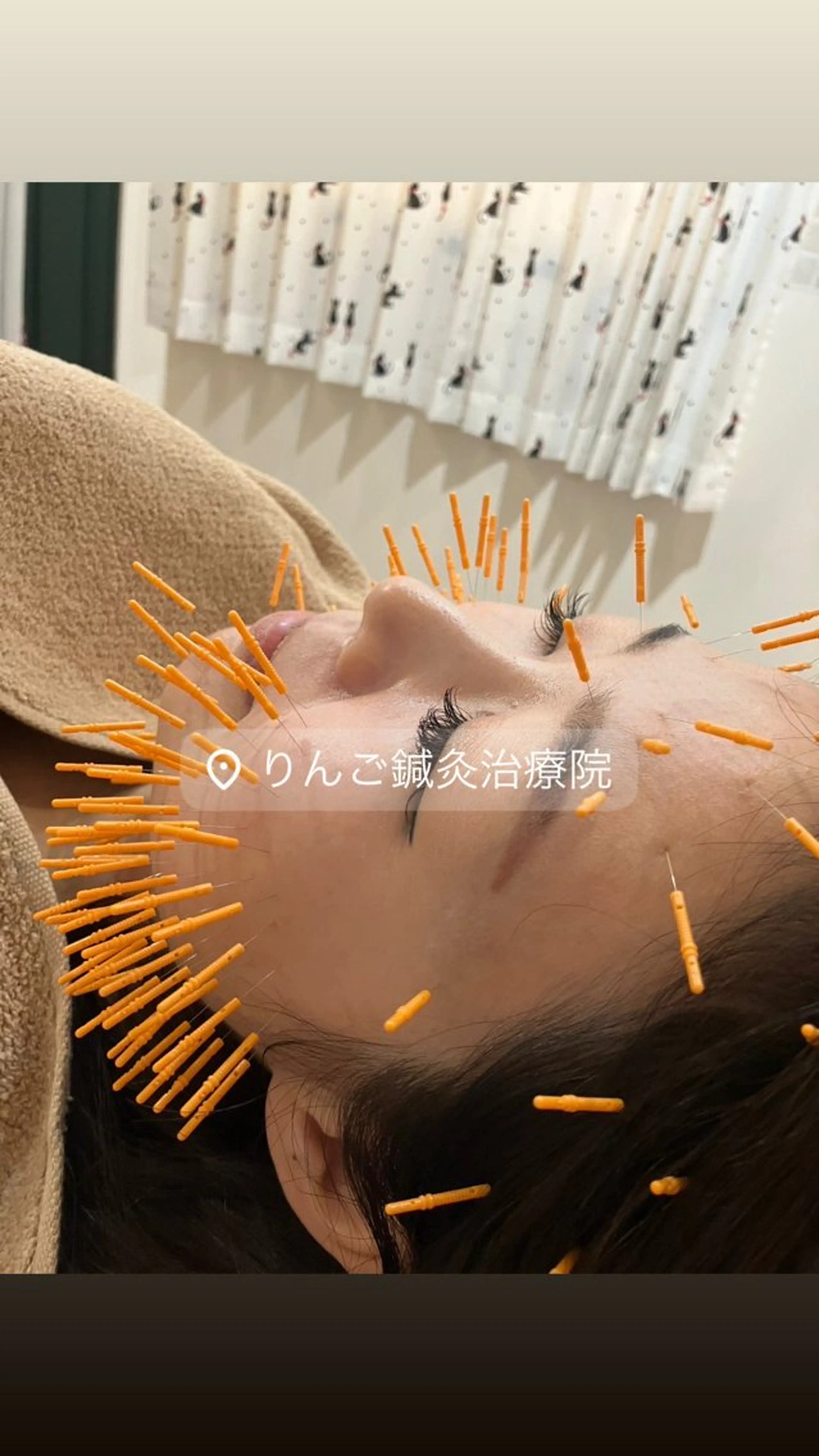 エステ リラク 美容鍼灸女性専用 りんご鍼灸治療院のその他イメージ