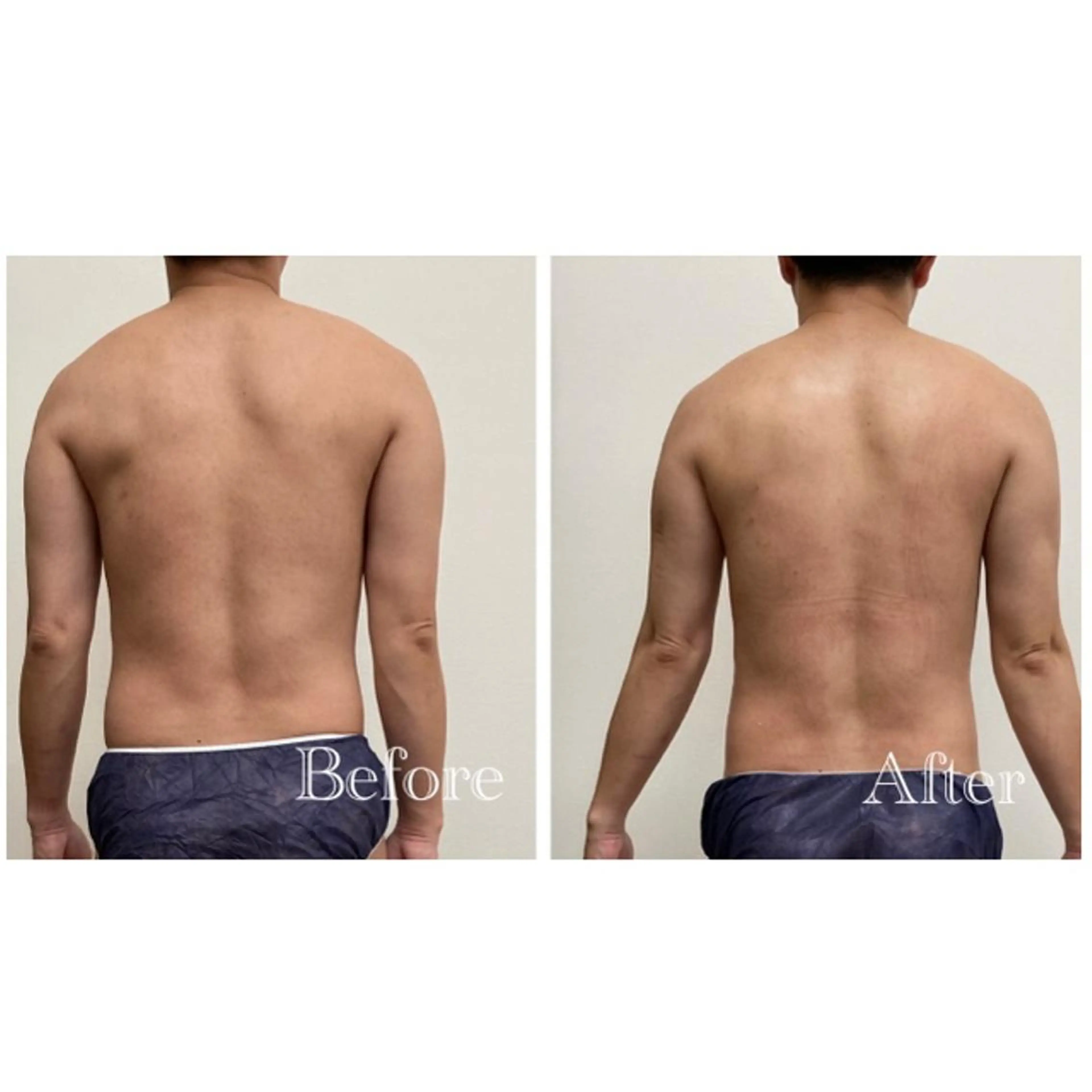 エステ リラク Natalieナタリー所属・Natalie Sayuriのエステ・リラクイメージ