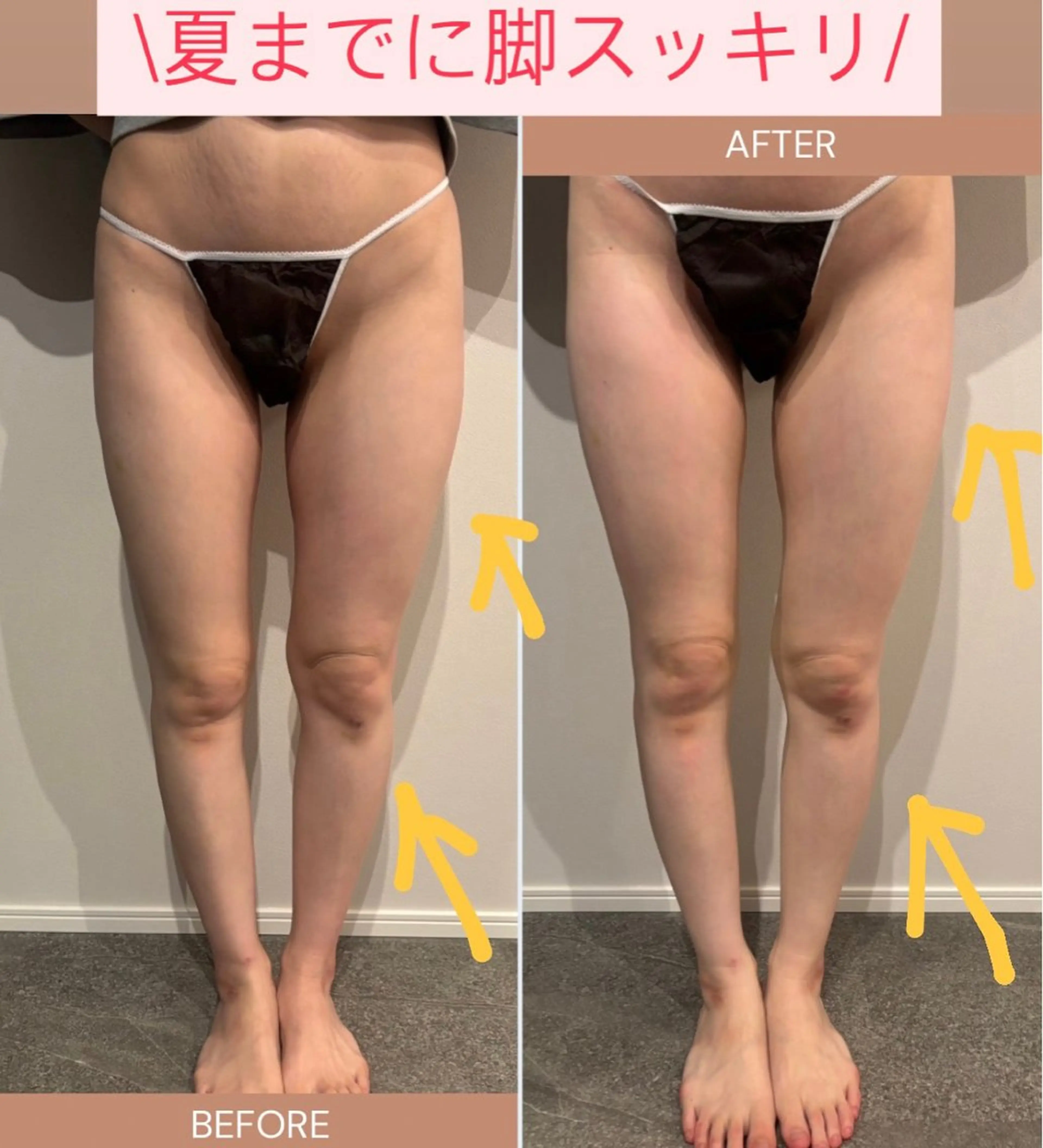 vinos beautyのエステ・リラクイメージ