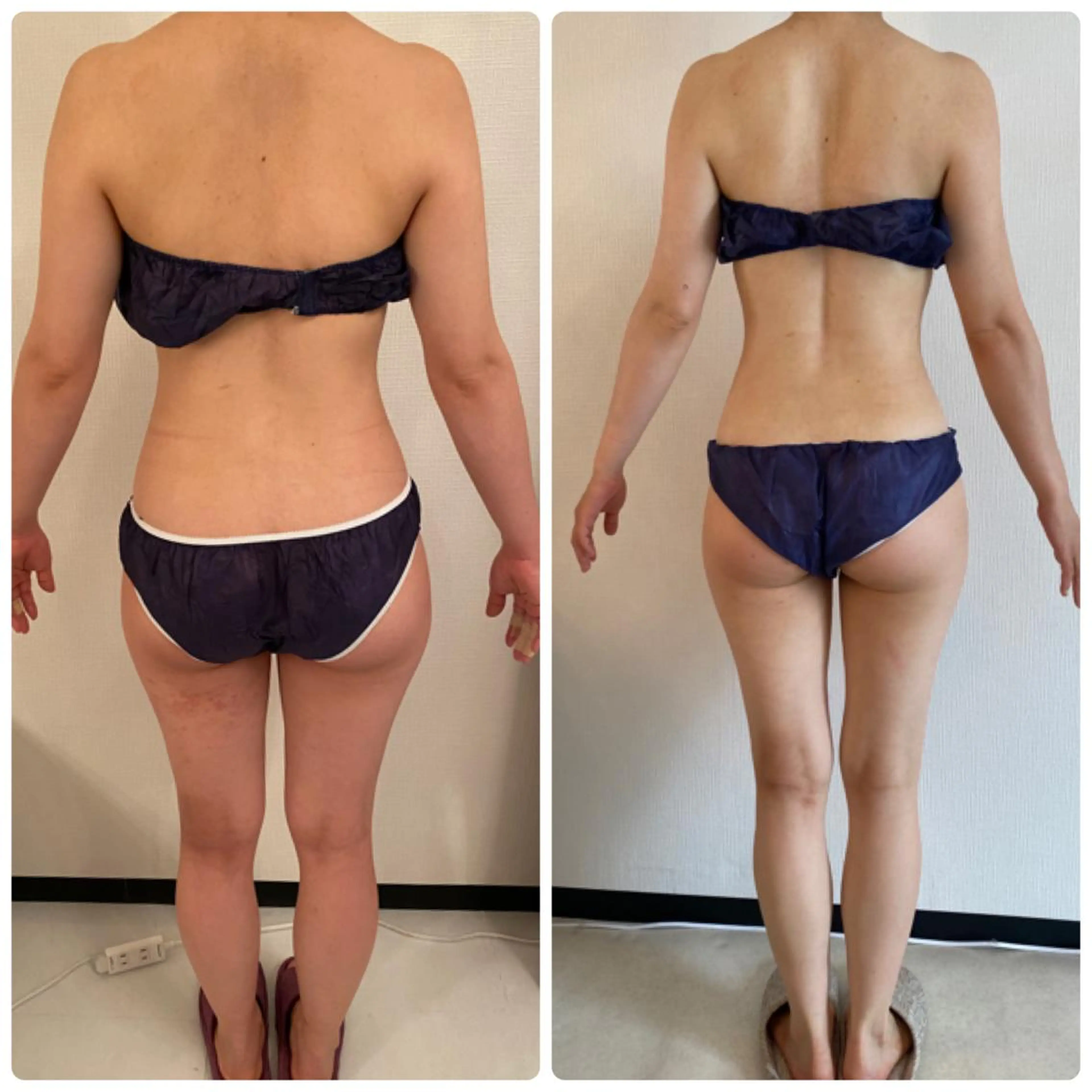 FLEUR大阪・整体 ・ハイフ・痩身・小顔のエステ・リラクイメージ