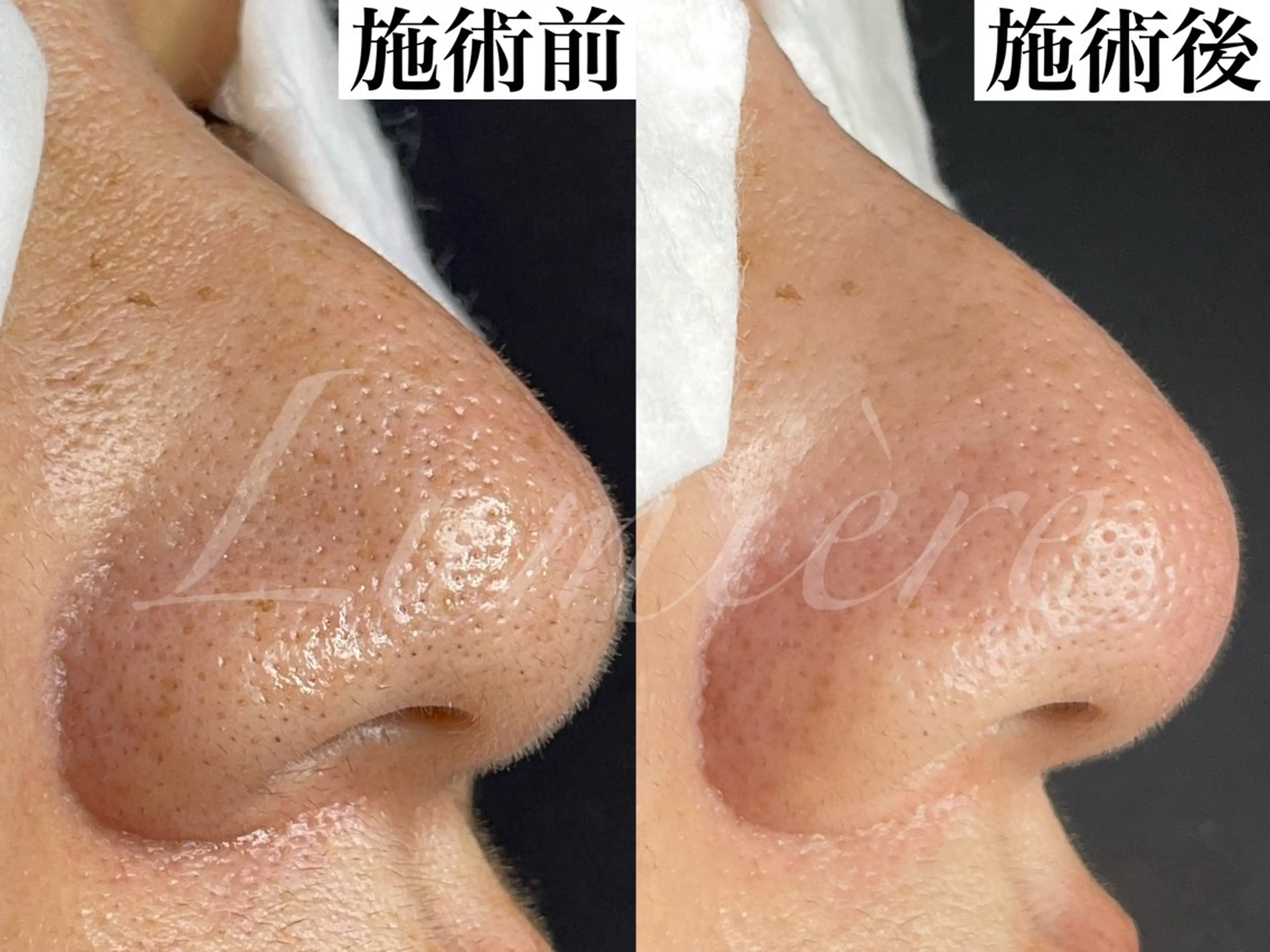 毛穴が綺麗になる 隠れ家サロン　南森町のエステ・リラクイメージ