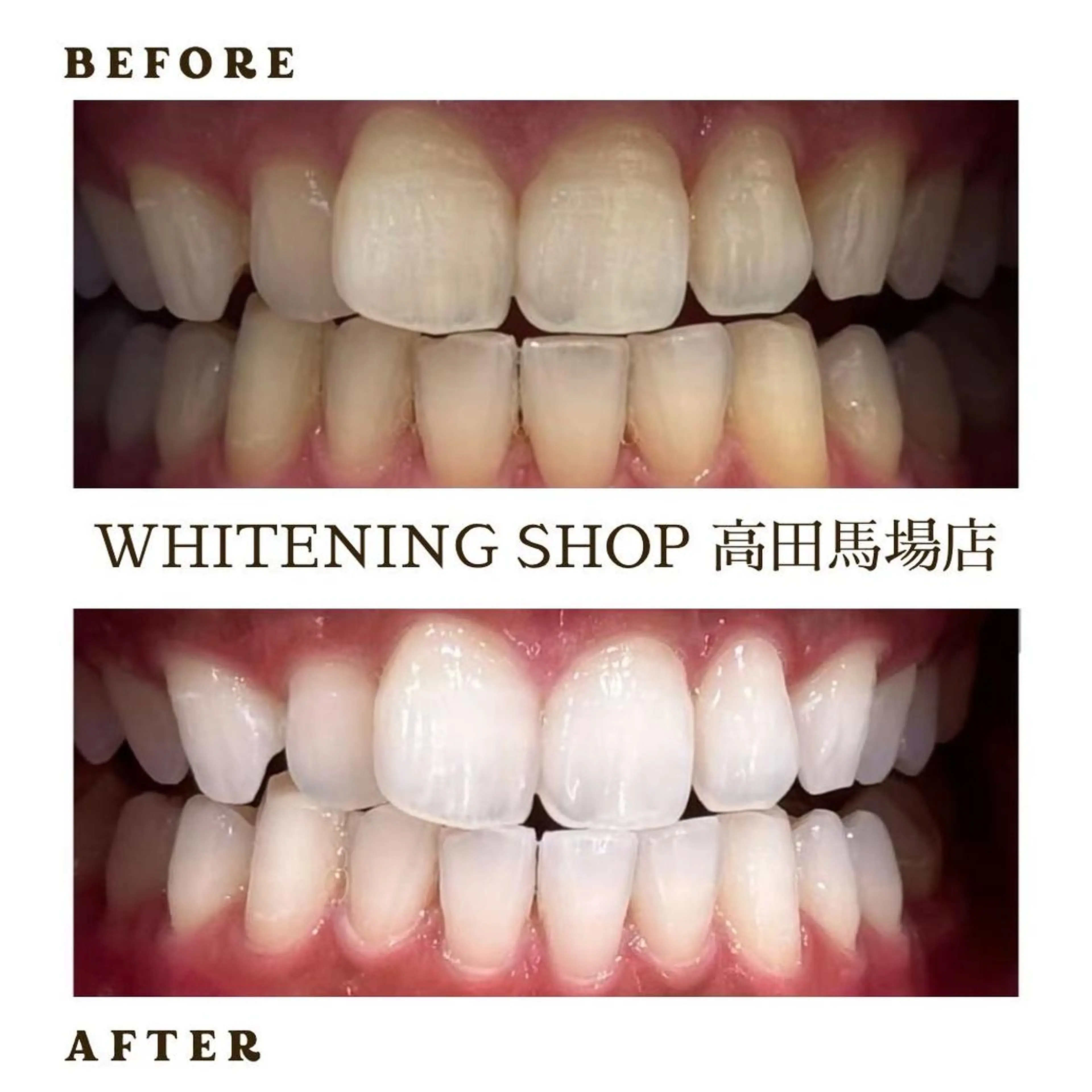 メンズ その他 ホワイトニング ショップ高田馬場店のその他イメージ