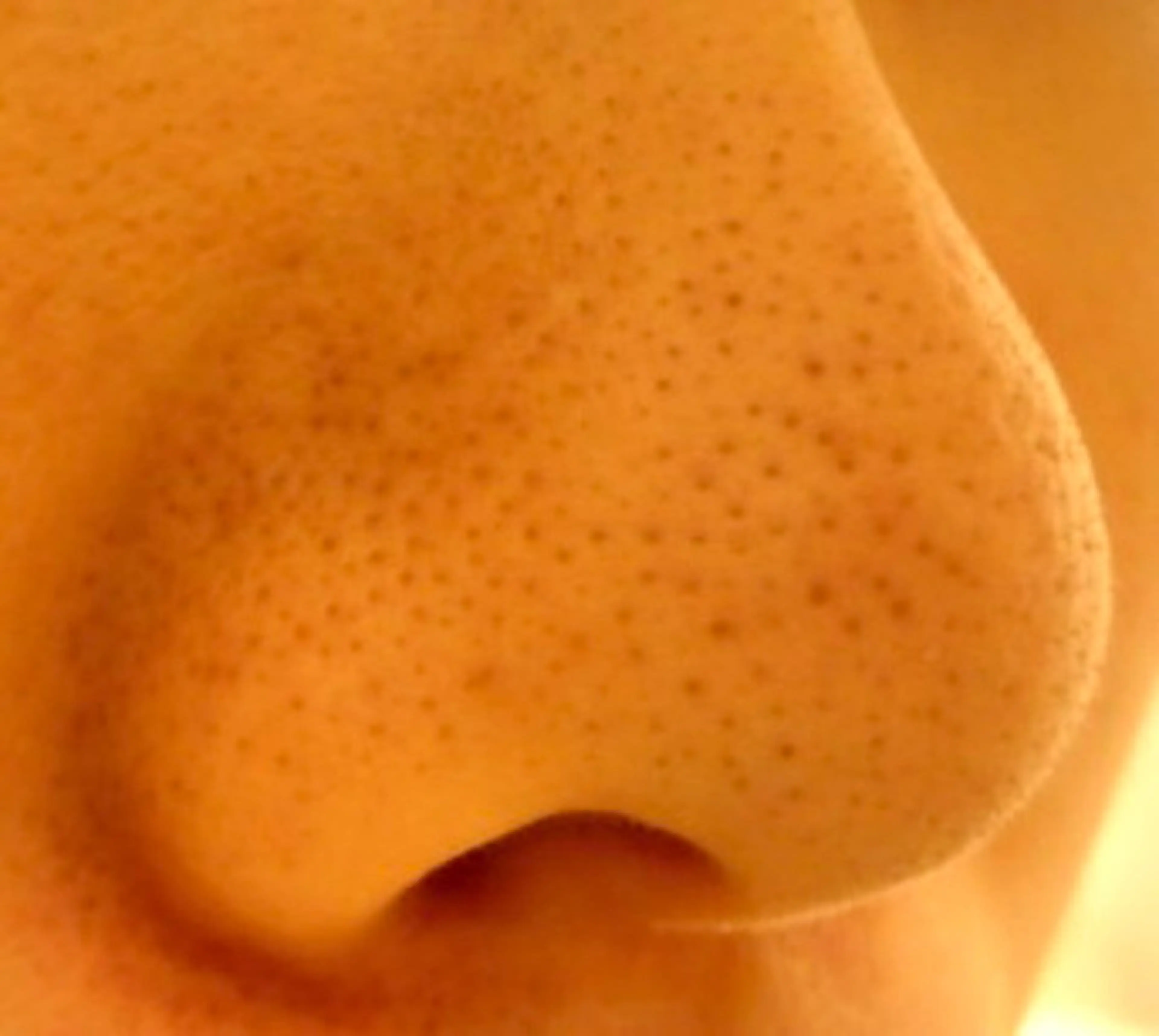 ピーリングサロン シャンテール所属・ピーリングサロン シャンテールのエステ・リラクイメージ