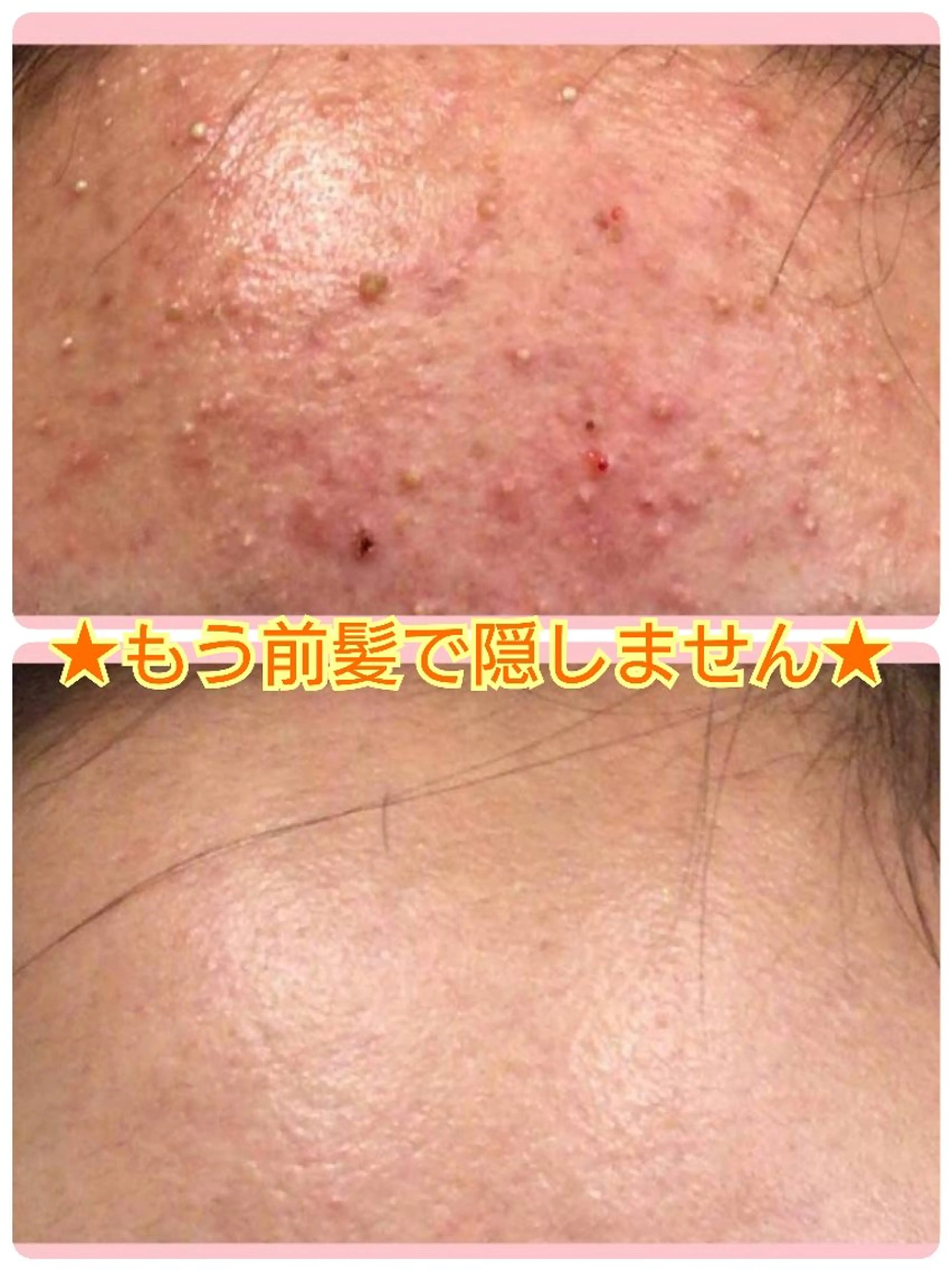 エステ ハーブピーリング 専門店Kikkaのエステ・リラクイメージ