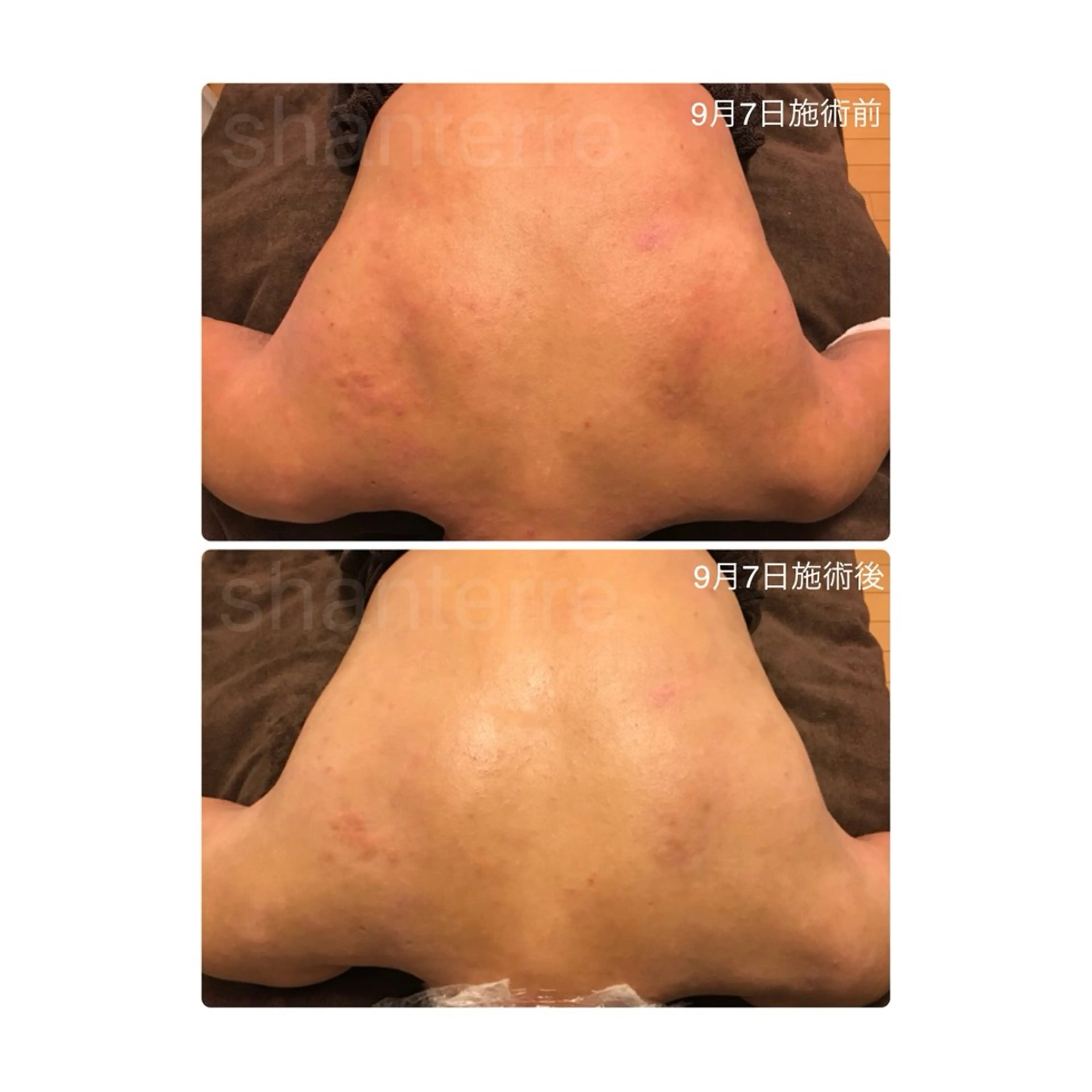 ピーリングサロン シャンテール所属・ピーリングサロン シャンテールのエステ・リラクイメージ