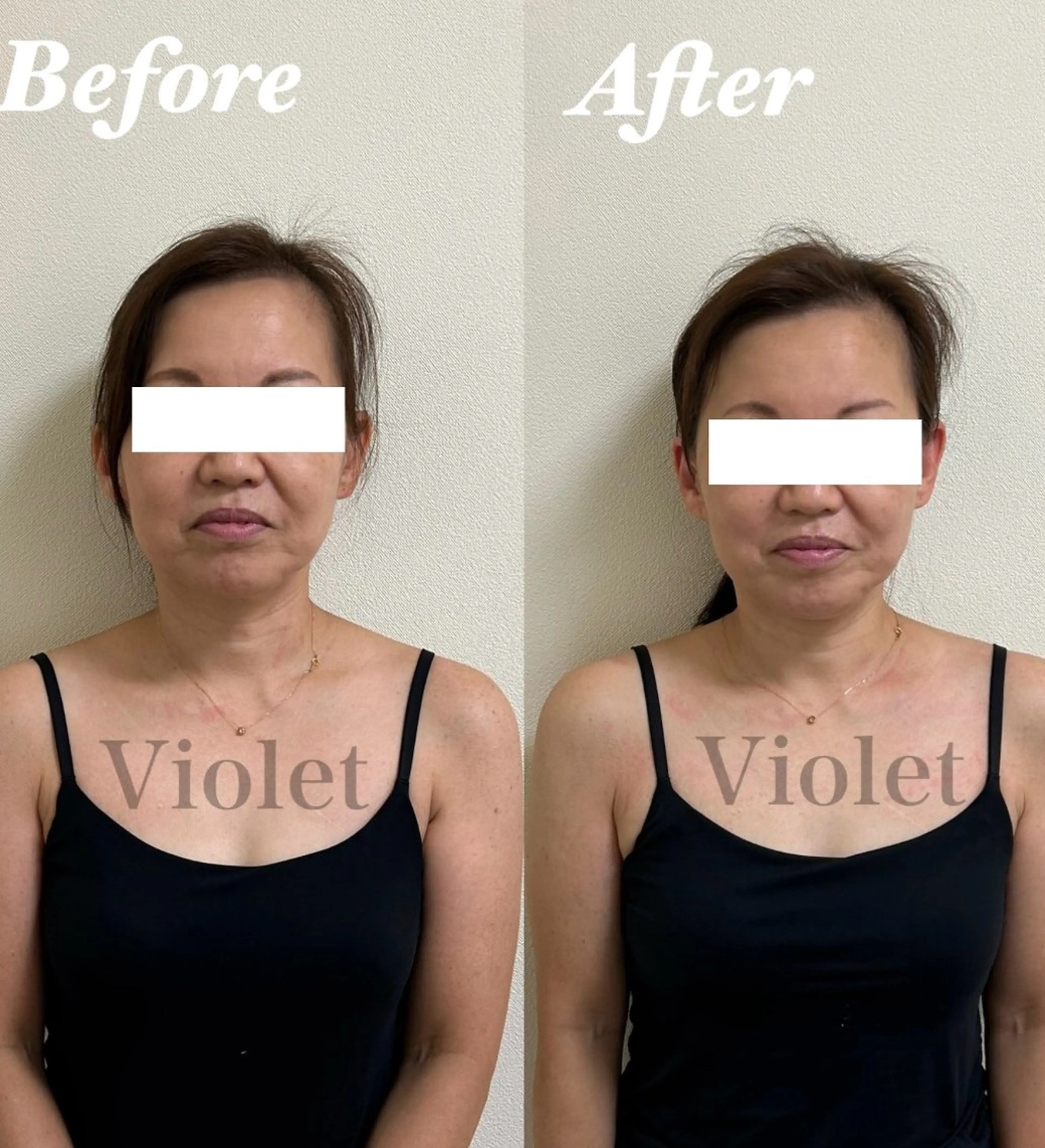 エステ リラク 耳つぼサロン バイオレット　りののその他イメージ