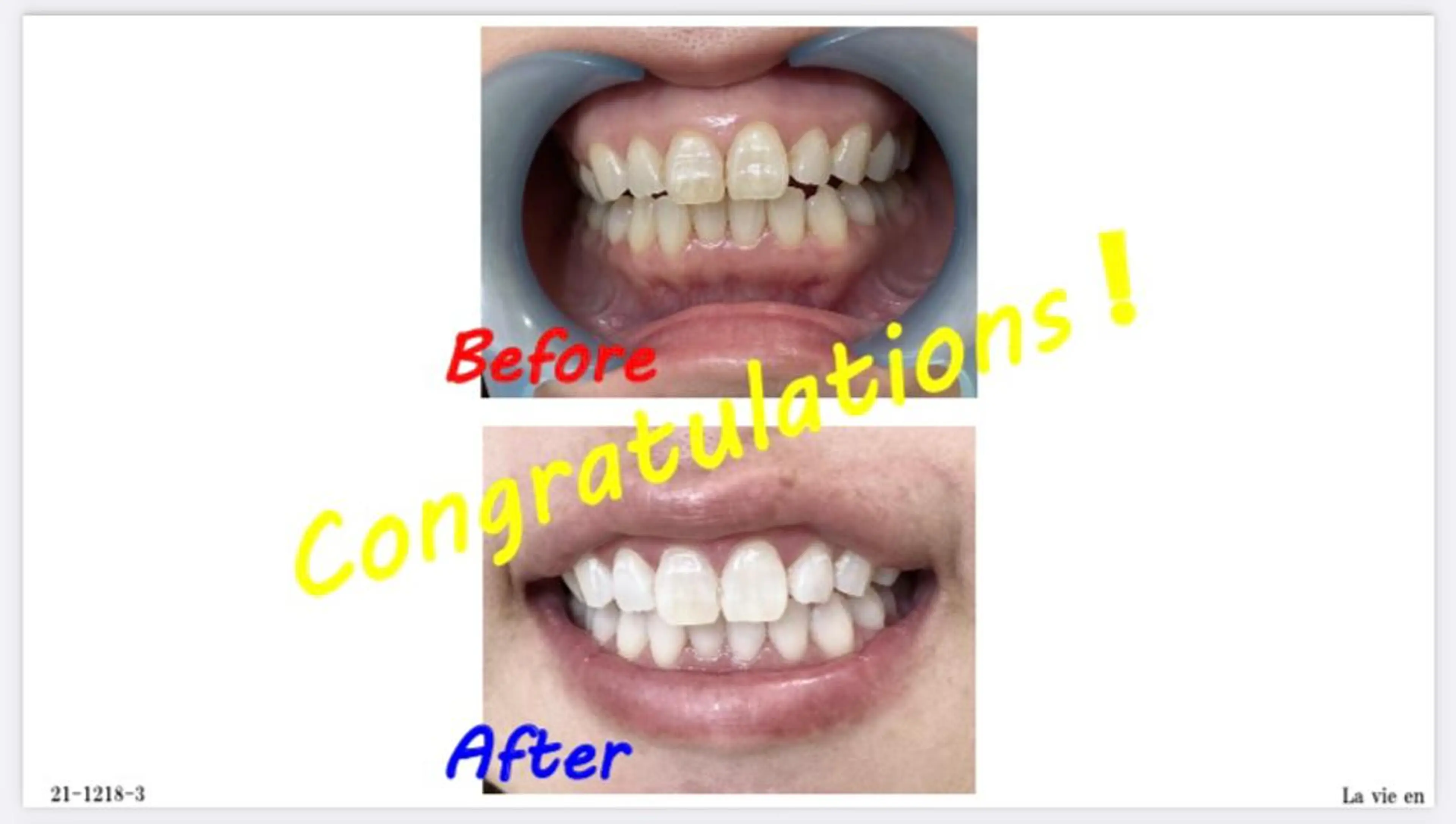 その他 セルフホワイトニングサロン　ラヴィアン所属・ホワイトニングサロン La vie enのその他イメージ