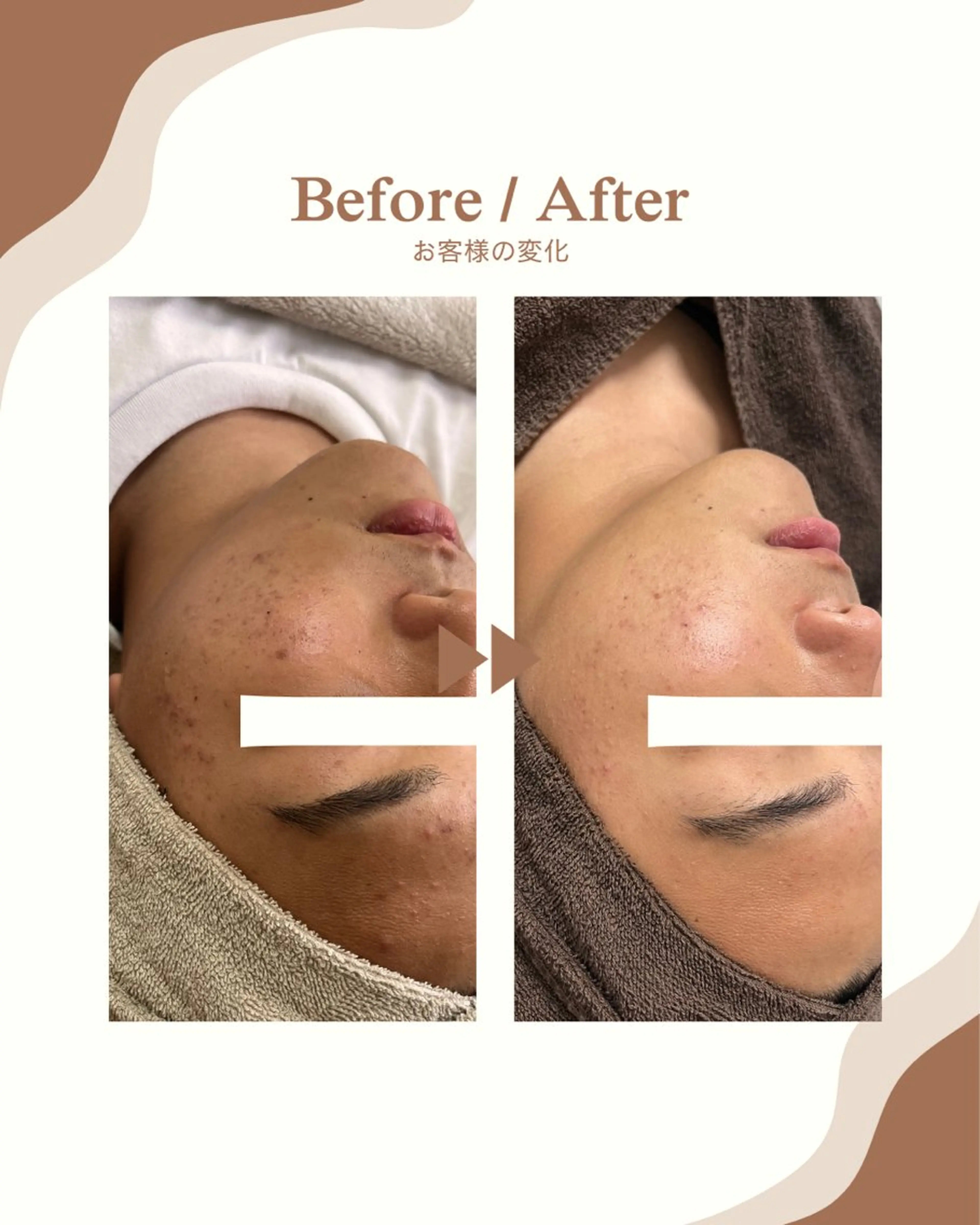 エステ 1st｜フェイシャル エステ専門店のエステ・リラクイメージ