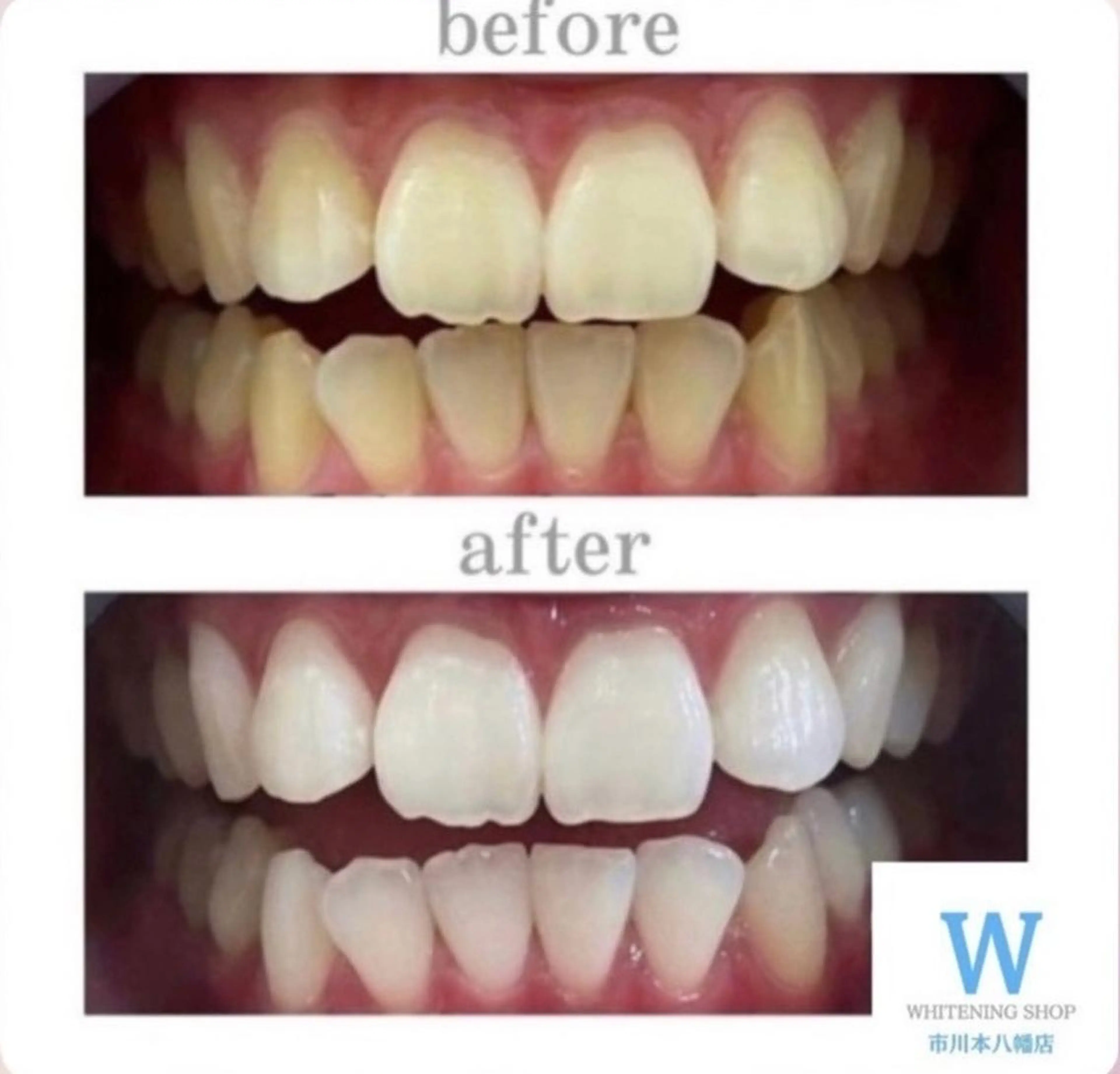 メンズ エステ リラク ホワイトニング ショップ本八幡店のエステ・リラクイメージ