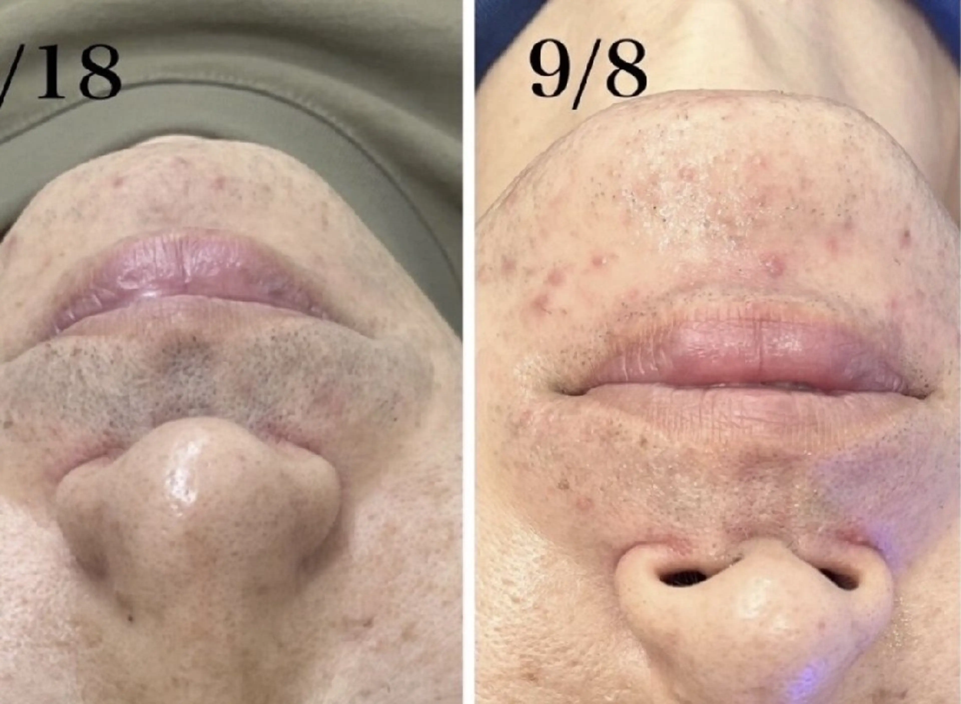 メンズ 脱毛 まつげパーマ×眉毛×脱毛　Cerise Lala所属・まつげパーマ眉毛脱毛 スリーズララ大船店のエステ・リラクイメージ