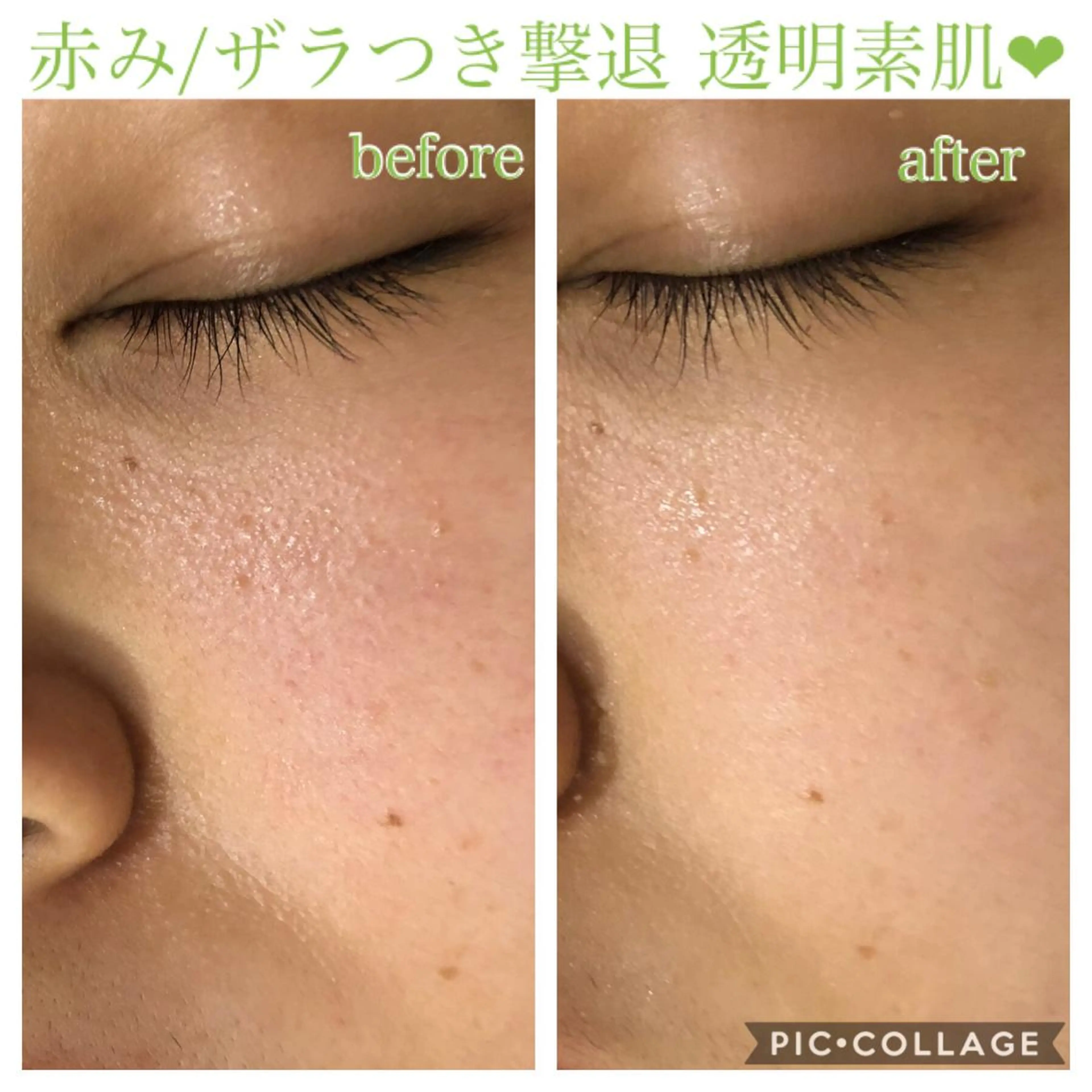 ショート カラー パーマ ヘアアレンジ キッズ ネイル マツエク・マツパ エステ リラク Ensor Clair所属・EnsorClair 代表 野口真央のエステ・リラクイメージ