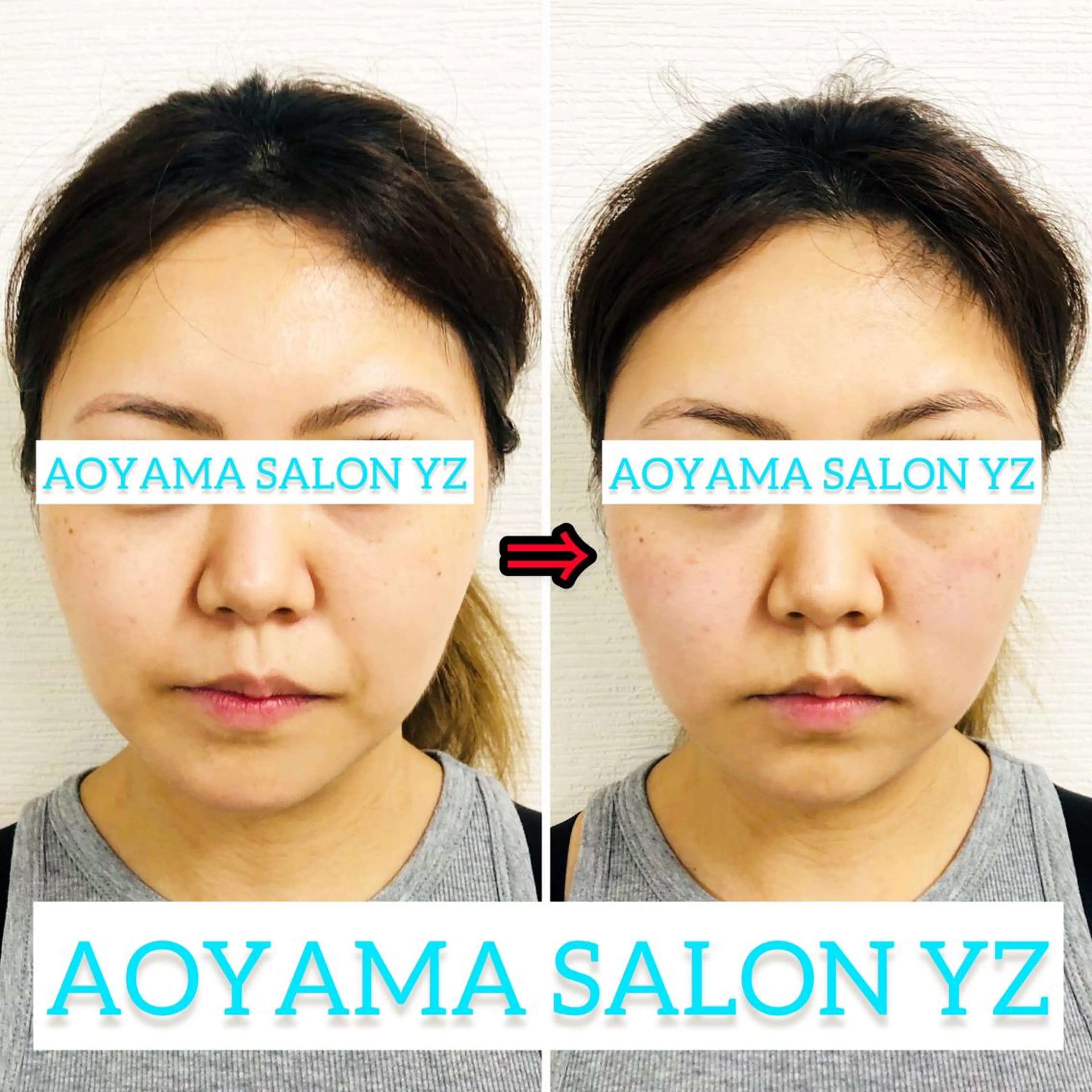 エステ リラク 小顔美容鍼専門サロン 渋谷YZのエステ・リラクイメージ