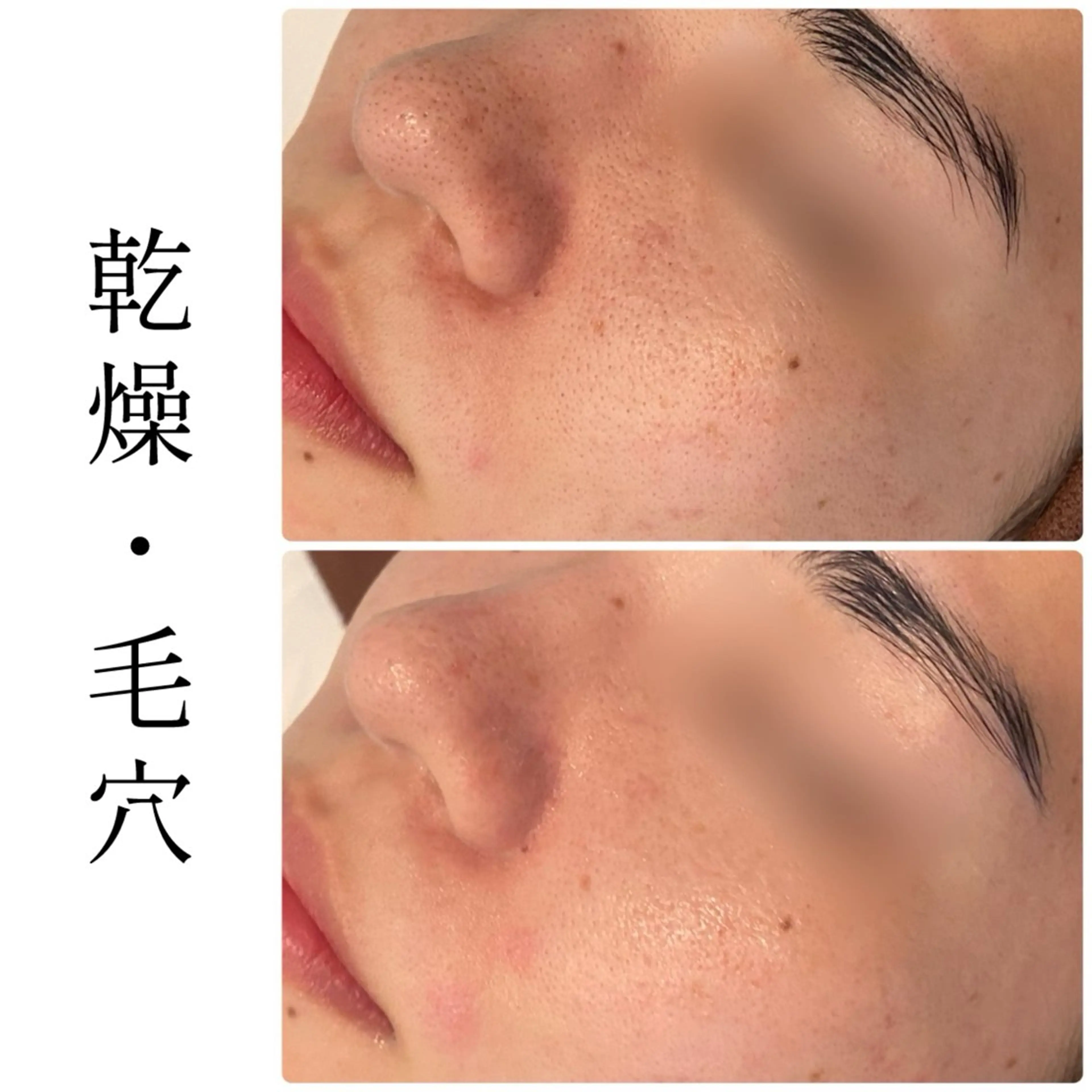 エステ ハーブピーリング専門 BIOEL横浜のエステ・リラクイメージ