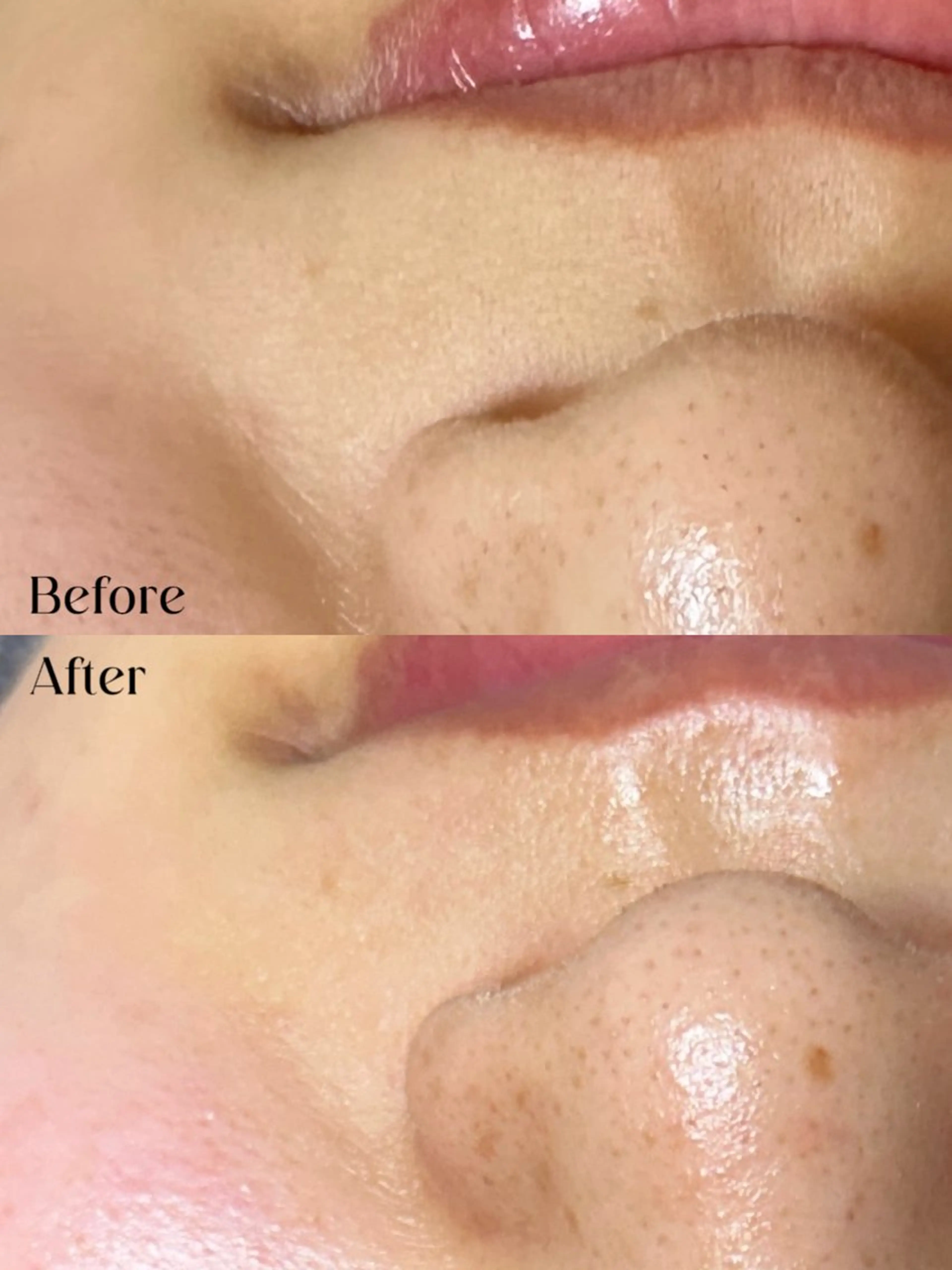 Hit. シュガーリング豊橋のエステ・リラクイメージ