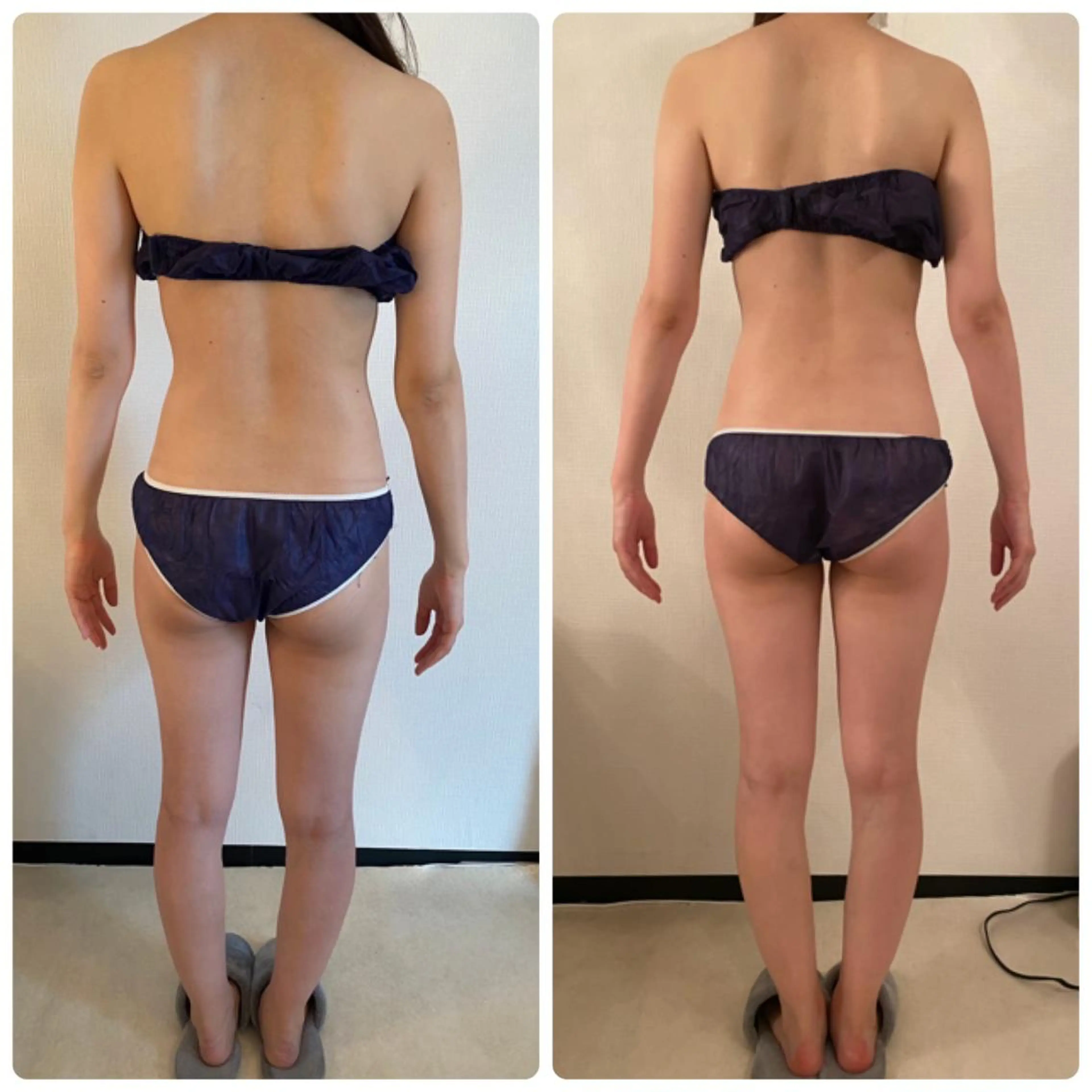 エステ リラク FLEUR大阪・整体 ・ハイフ・痩身・小顔のエステ・リラクイメージ